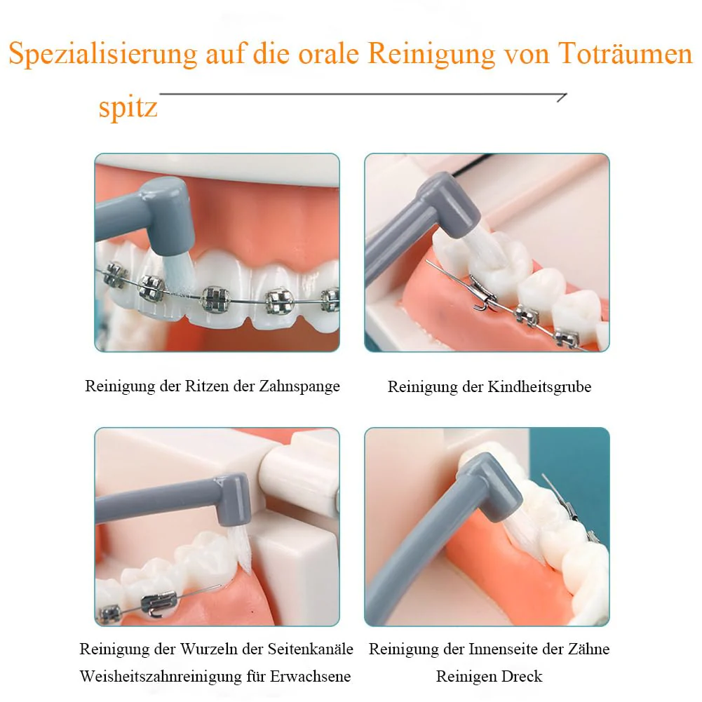 2 Büschelzahnbürsten, Büschelzahnbürste Brush, 1 Flache Büschelzahnbürste, 1 Spitze Büschelzahnbürste, Interdentalbürste Für Kieferorthopädische Zahnspangen Und Brückenreinigung (Blau, 16cm*2cm) Blau (Farbe) - Image 5