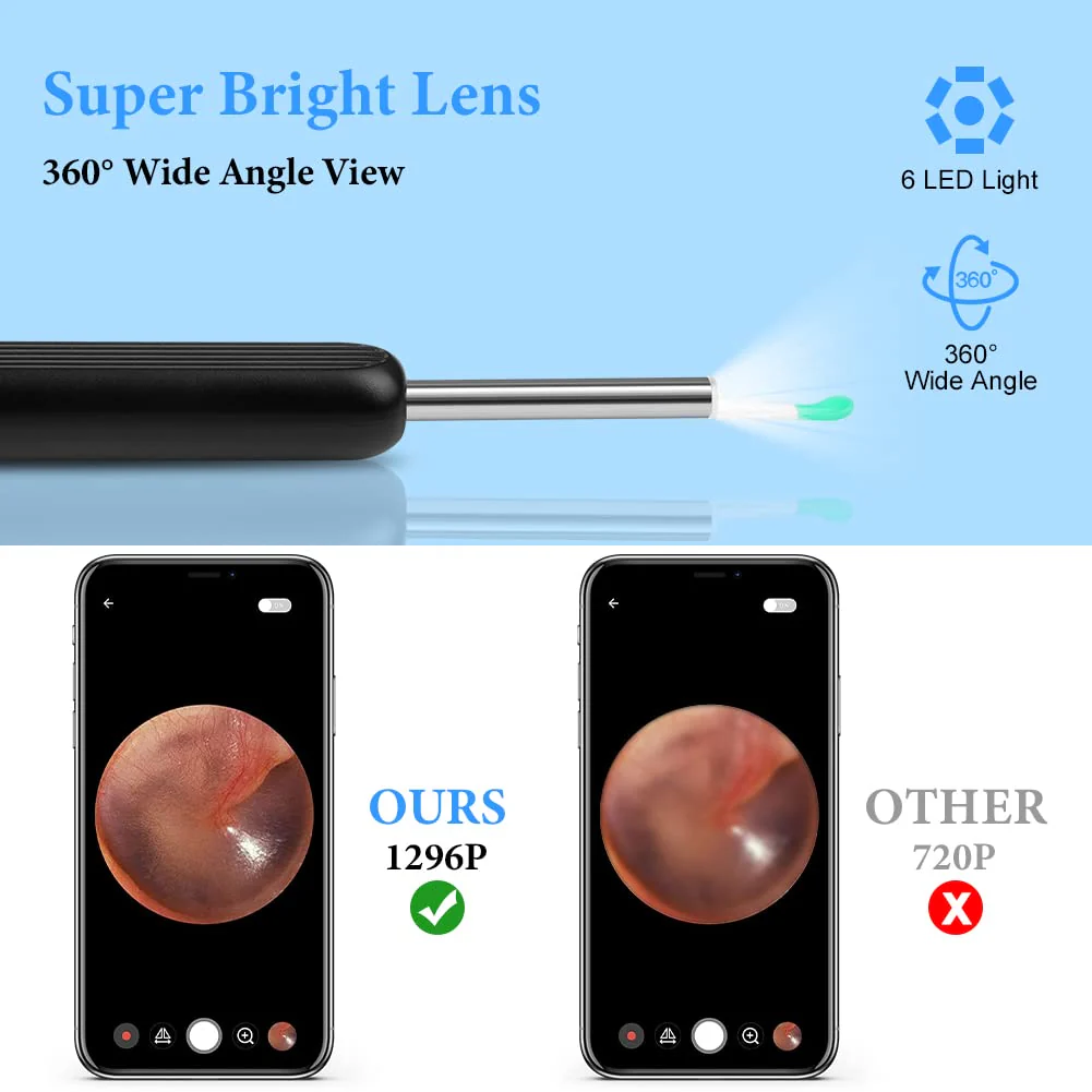 ACWOO Ear Wax Remover Otoscope, Ear Cleaner Camera Ultra Thin, IP67 Waterproof Ear Endoscope Ear Cleaner for Adults, Wireless HD Otoscope for Adults, Children and Pets, Black - Image 4