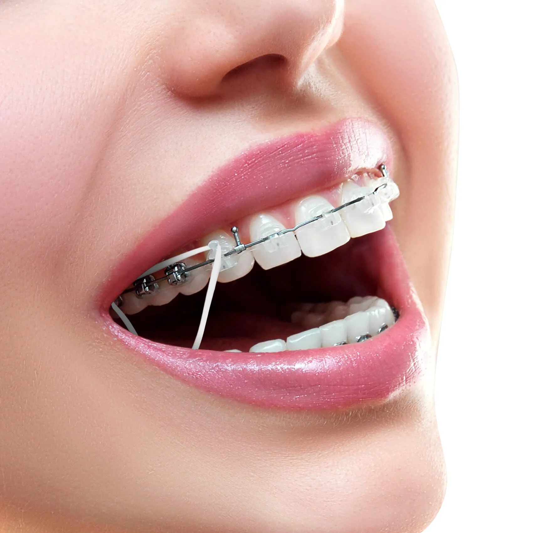 Annhua Dental Braces with 5 Placements, 500 Pieces Braces Orthodontic Elastic Rubber Bands for Braces, Gap Teeth, Crooked Teeth, etc. (Rabbit 3/16 Inch 3.5 oz) Rabbit 3/16" 3.5oz - Image 4