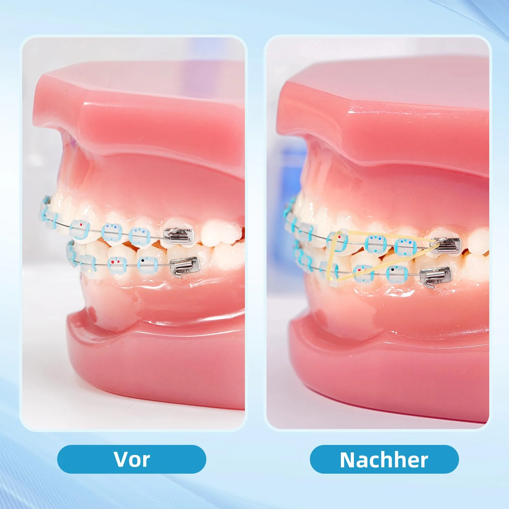 Annhua Dental Braces with 5 Placements, 500 Pieces Braces Orthodontic Elastic Rubber Bands for Braces, Gap Teeth, Crooked Teeth, etc. (Rabbit 3/16 Inch 3.5 oz) Rabbit 3/16" 3.5oz - Image 7