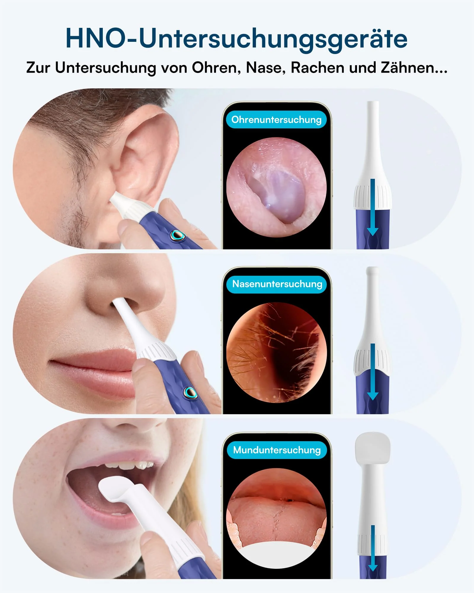 BEBIRD Earsight Plus D39R Ear Wax Remover Otoscope, 1920P HD Flexible Ear Cleaner Camera with Tweezers, Ear Cleaner Camera for Ear/Nose/Neck Examinations (Blue) Blue - Image 5
