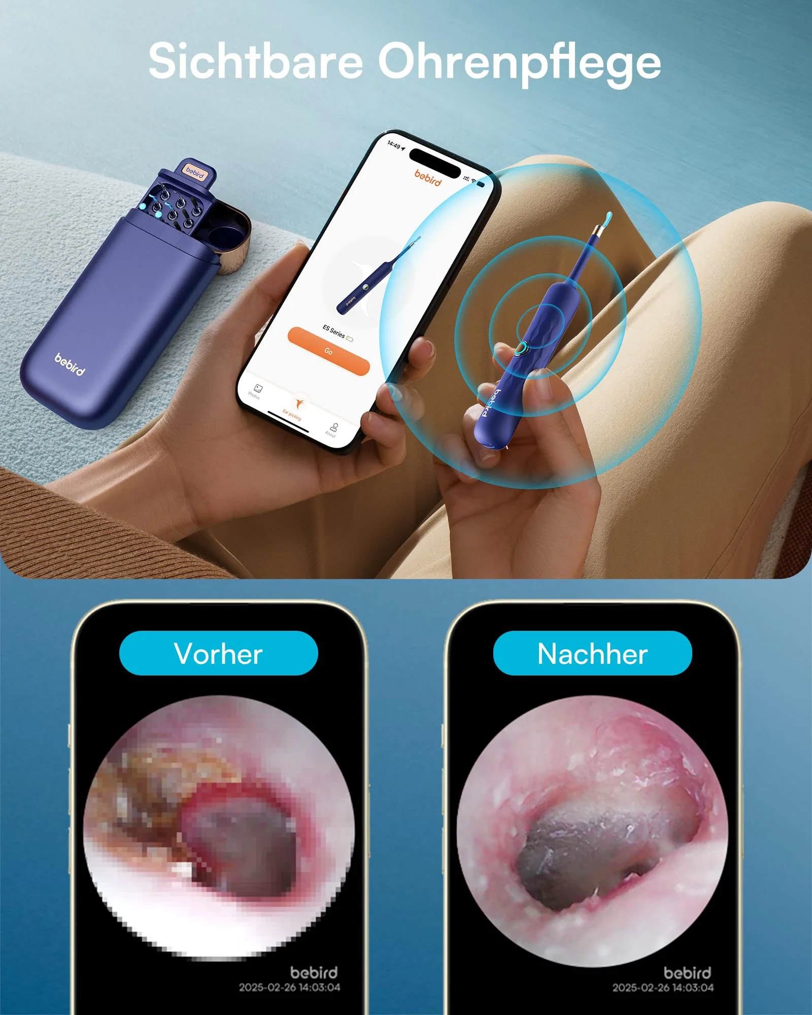 BEBIRD Earsight Plus D39R Ear Wax Remover Otoscope, 1920P HD Flexible Ear Cleaner Camera with Tweezers, Ear Cleaner Camera for Ear/Nose/Neck Examinations (Blue) Blue - Image 6