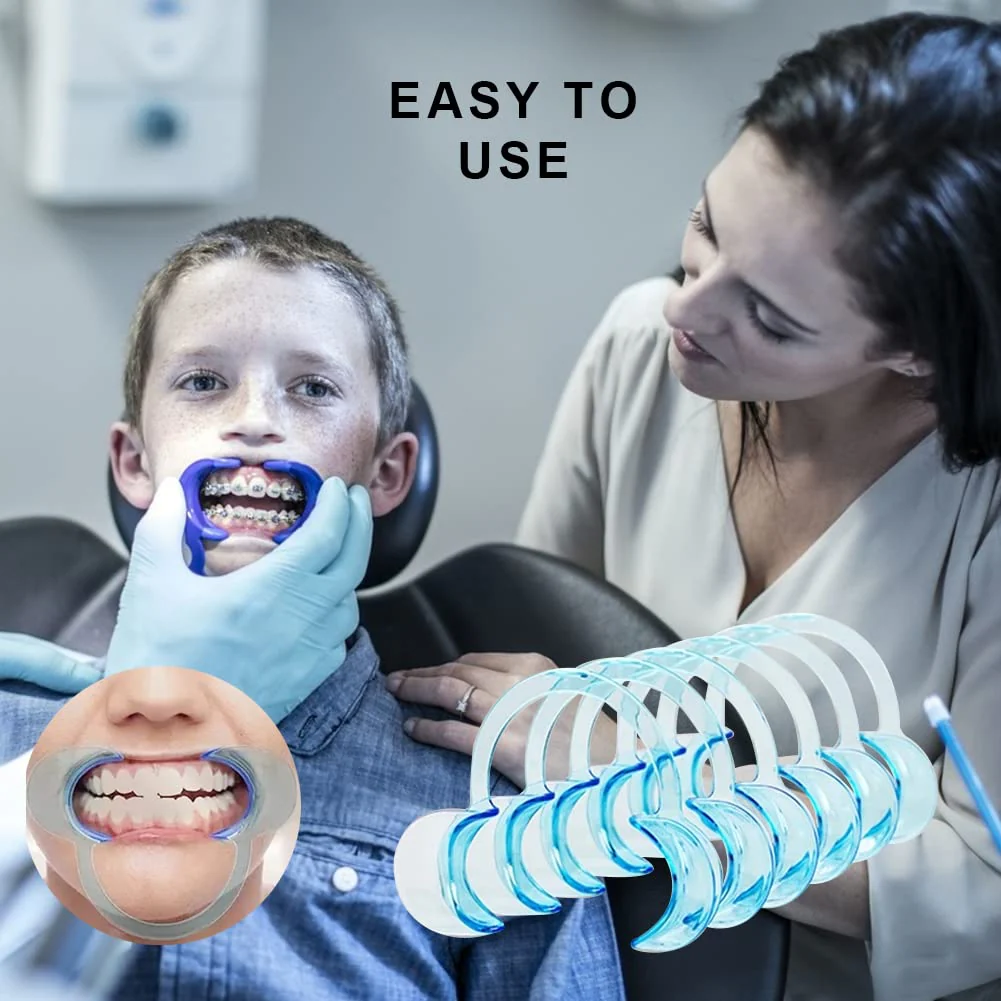C-Shape Mouth Opener, Dental C-Shape Mouth Opener, Mouth Opener Challenge, Cheek Holder, Mouth Angle Holder, for Oral Examination, Treatment, Teeth Whitening - Image 3