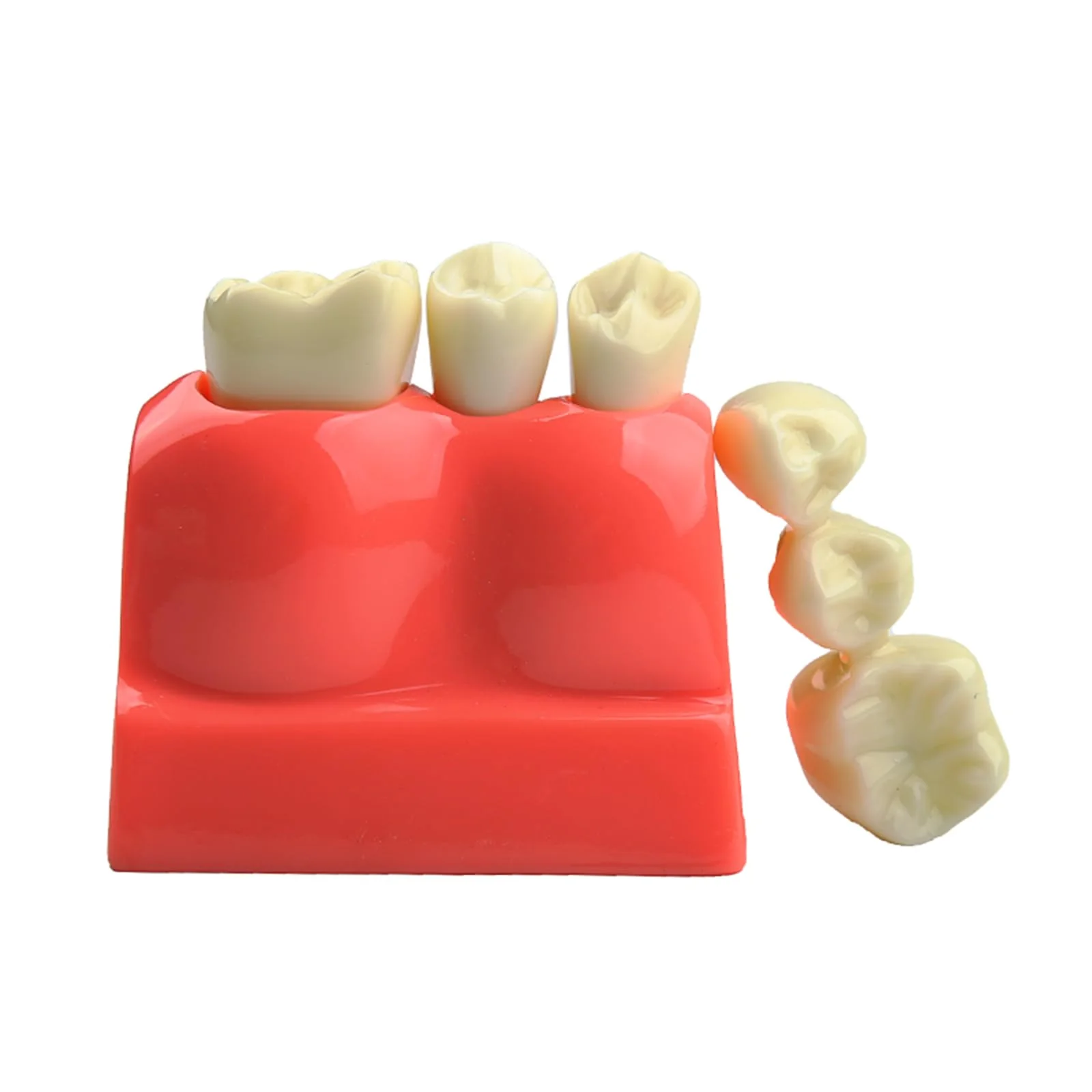 Dental Implant Model Removable Crown Bridge 4 Teeth Demonstration Model for Teaching Demonstration, Patient Education and Student Learning - Image 7