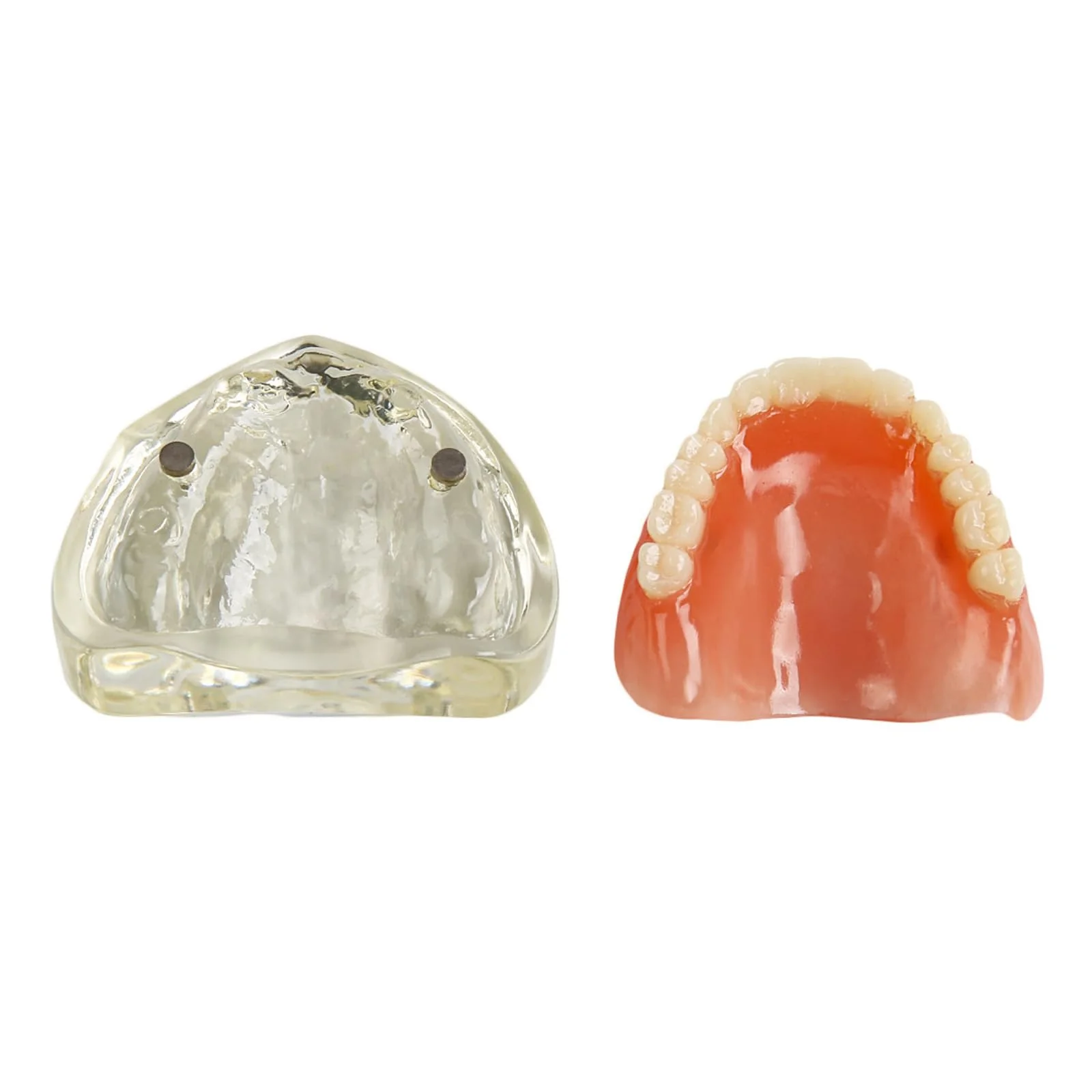 Dental Model Upper Jaw Deck Prosthesis with 2 Implants for Training and Study (Upper Jaw) - Image 3