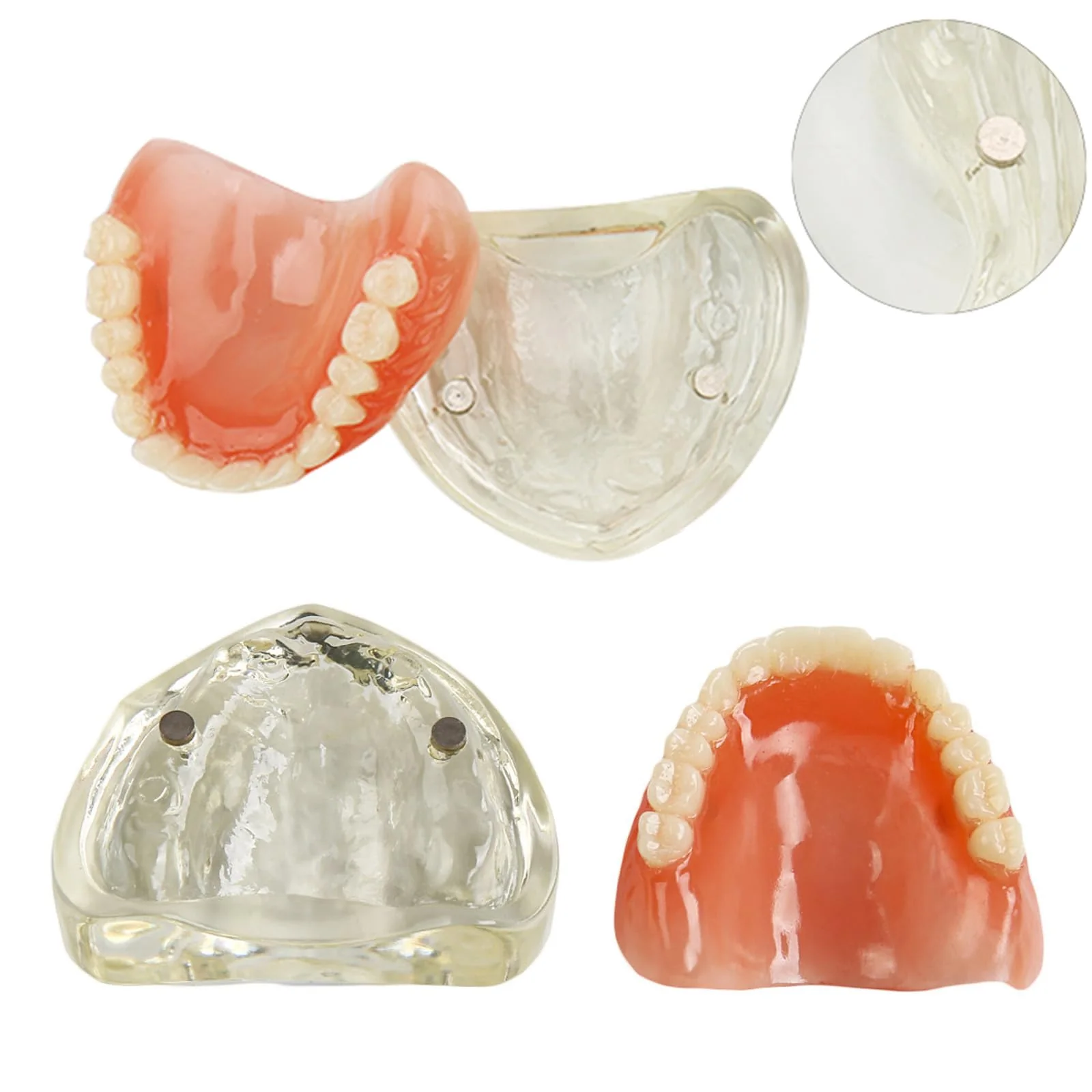 Dental Model Upper Jaw Deck Prosthesis with 2 Implants for Training and Study (Upper Jaw) - Image 4