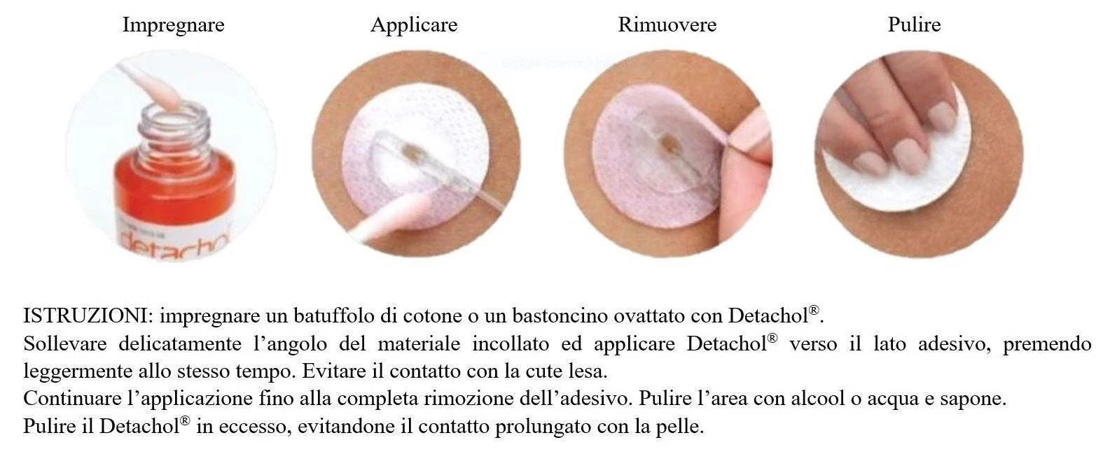 Detachol Adhesive Remover - 2 x 15ml Bottles Ideal for Freestyle Libre, Dexcom - Image 2