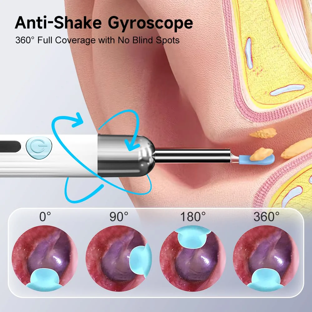 Ear Wax Remover Otoscope, 1080P WiFi Ear Cleaner with UV-C Charging Station, IP67 Waterproof Otoscope Ear with 6 LEDs for iOS and Android Smartphones Digital Ear Scoop with Camera - Image 6