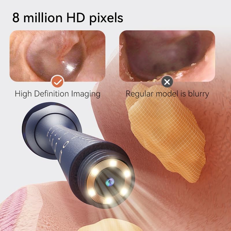 Ear Wax Remover Otoscope, Ear Wax Removal Camera Light Tool Set, 1080P HD WiFi Ear Cleaner with 4 LEDs, IP67 Waterproof & 360° Wide Angle Otoscope Camera, for iPhone, Android, iPad - Image 5