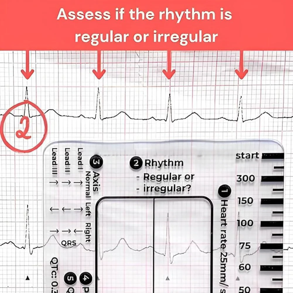 ECG 7 Step Ruler, ECG 7 Step Ruler for ECG/EKG Interpretation, ECG Ruler Plastic Ruler Measuring Tool, ECG Ruler Transparent, ECG Ruler Pocket etcard, Easy-to-Carry ECG Ruler (2 Pieces (with box)) - Image 4