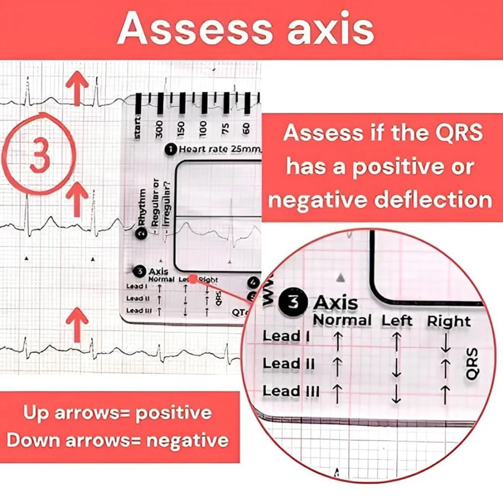 ECG 7 Step Ruler, ECG 7 Step Ruler for ECG/EKG Interpretation, ECG Ruler Plastic Ruler Measuring Tool, ECG Ruler Transparent, ECG Ruler Pocket etcard, Easy-to-Carry ECG Ruler (2 Pieces (with box)) - Image 5