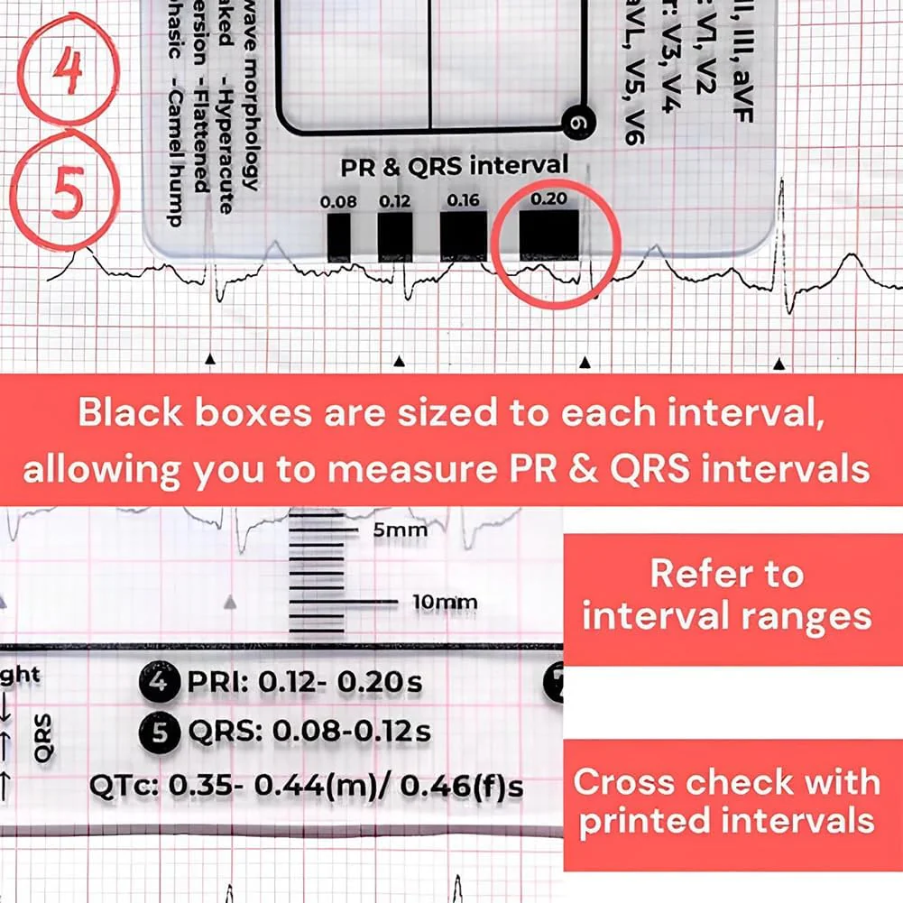 ECG 7 Step Ruler, ECG 7 Step Ruler for ECG/EKG Interpretation, ECG Ruler Plastic Ruler Measuring Tool, ECG Ruler Transparent, ECG Ruler Pocket etcard, Easy-to-Carry ECG Ruler (2 Pieces (with box)) - Image 6