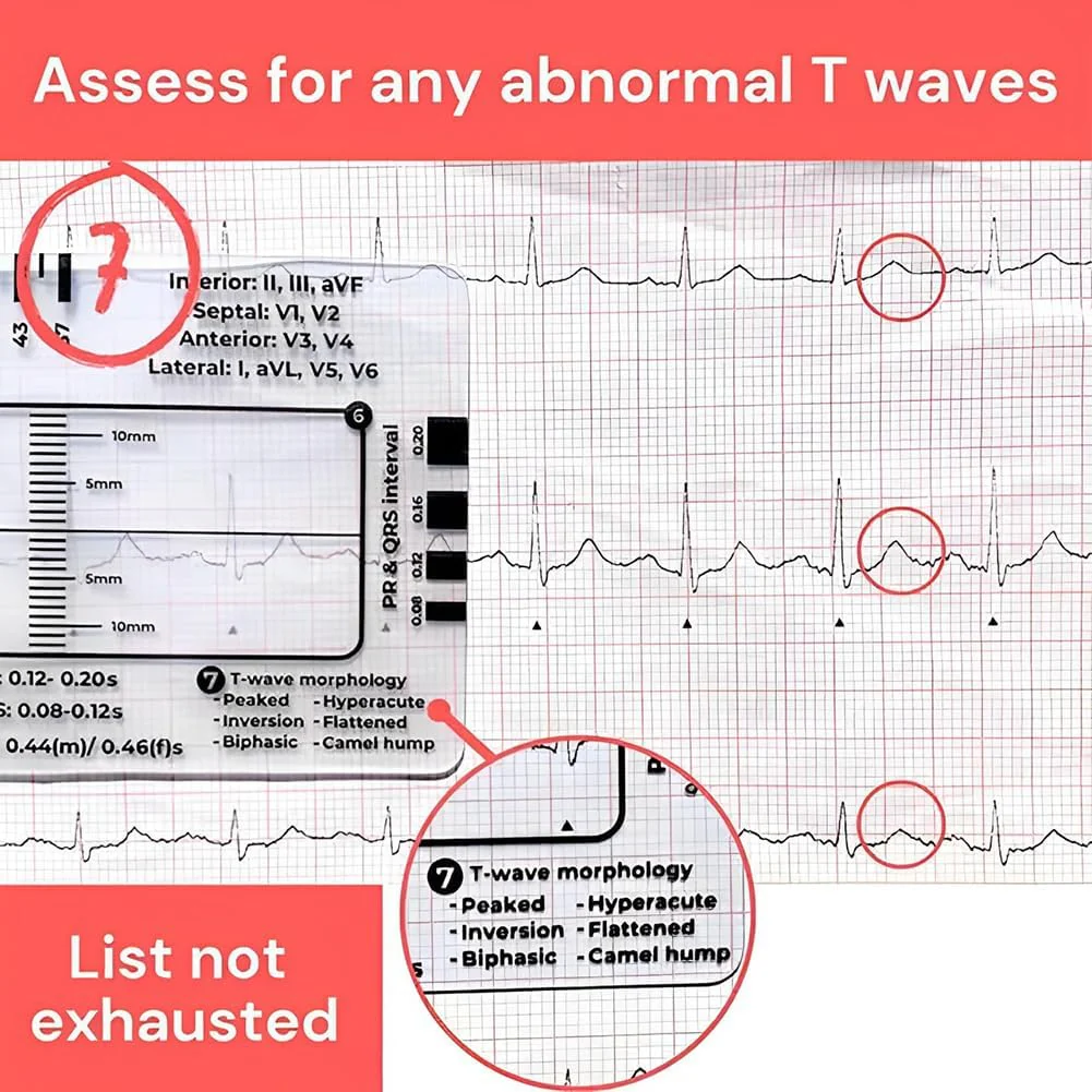 ECG 7 Step Ruler, ECG 7 Step Ruler for ECG/EKG Interpretation, ECG Ruler Plastic Ruler Measuring Tool, ECG Ruler Transparent, ECG Ruler Pocket etcard, Easy-to-Carry ECG Ruler (2 Pieces (with box)) - Image 8