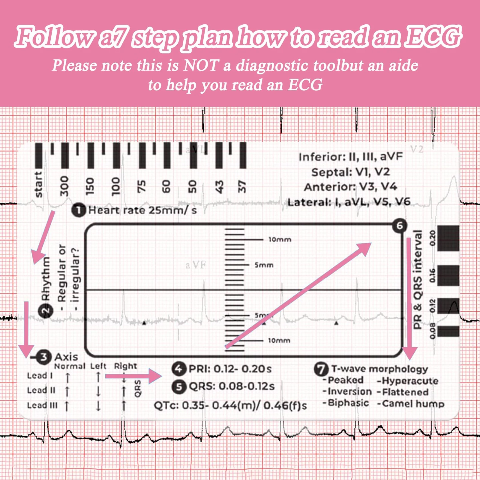 Ecg 7 Step Ruler, Ecg/Ekg 7 Step Ruler Card, Portable Ecg Ruler Plastic Ruler Measuring Tool, Provides Data Support, Wear-resistant and Durable, Suitable for Doctors, Medical Students, etc. - Image 2