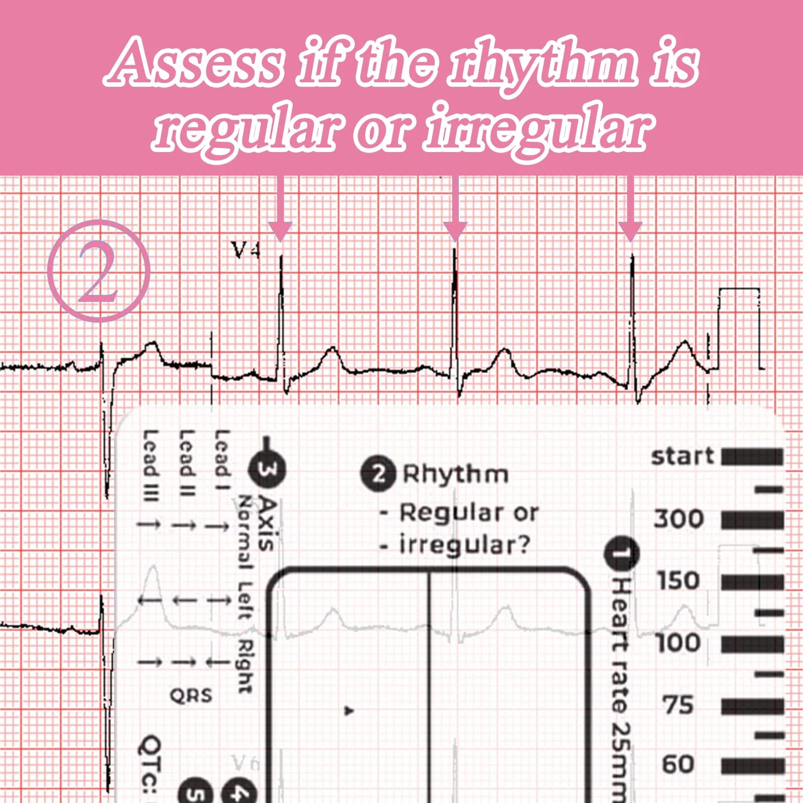 Ecg 7 Step Ruler, Ecg/Ekg 7 Step Ruler Card, Portable Ecg Ruler Plastic Ruler Measuring Tool, Provides Data Support, Wear-resistant and Durable, Suitable for Doctors, Medical Students, etc. - Image 4