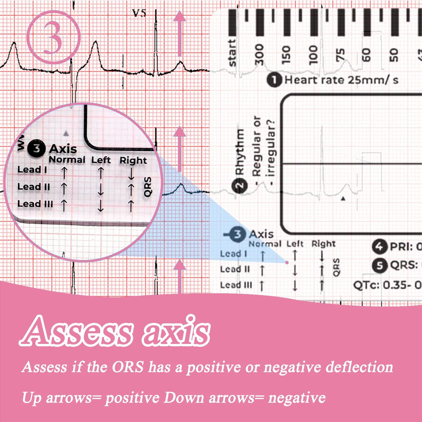 Ecg 7 Step Ruler, Ecg/Ekg 7 Step Ruler Card, Portable Ecg Ruler Plastic Ruler Measuring Tool, Provides Data Support, Wear-resistant and Durable, Suitable for Doctors, Medical Students, etc. - Image 5