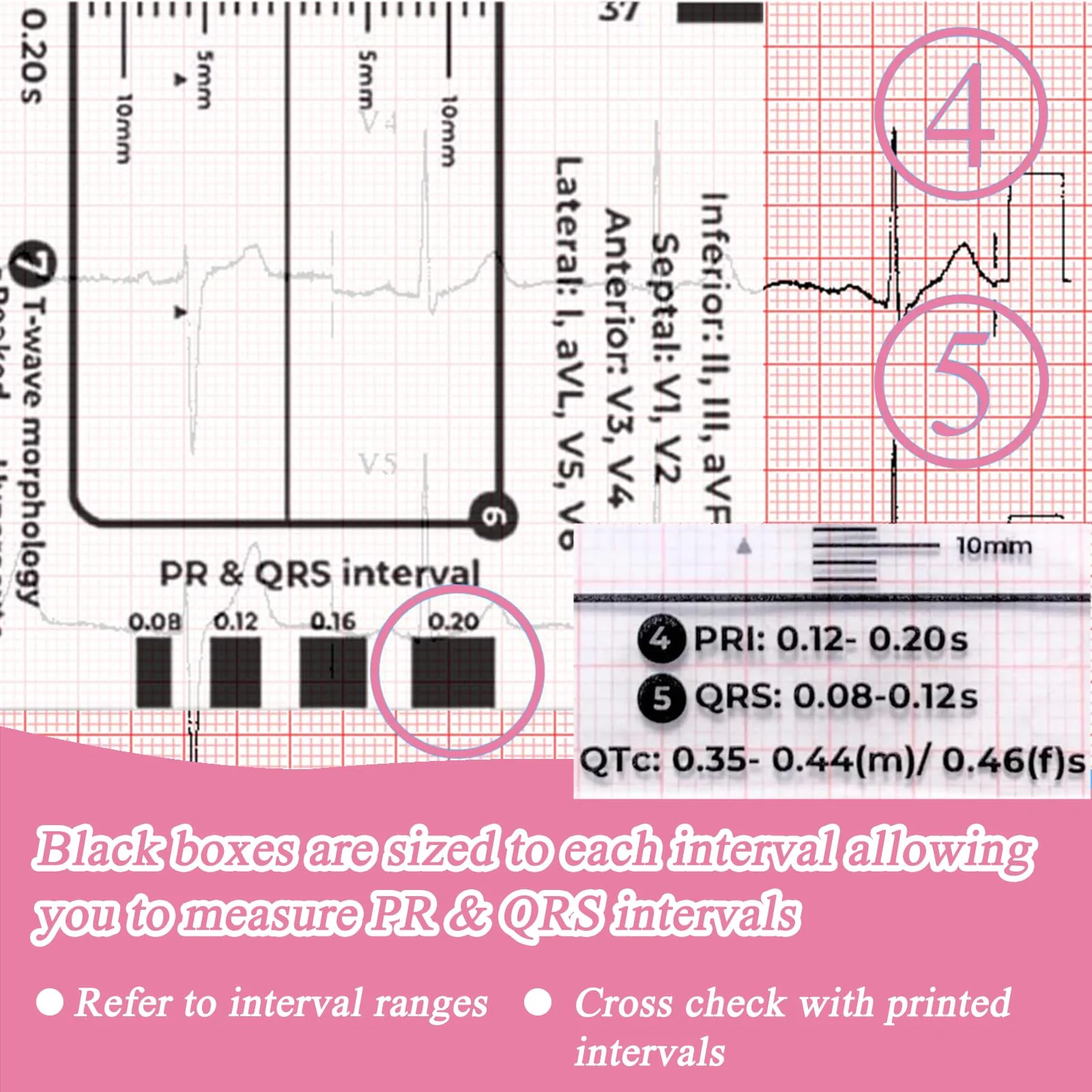 Ecg 7 Step Ruler, Ecg/Ekg 7 Step Ruler Card, Portable Ecg Ruler Plastic Ruler Measuring Tool, Provides Data Support, Wear-resistant and Durable, Suitable for Doctors, Medical Students, etc. - Image 6