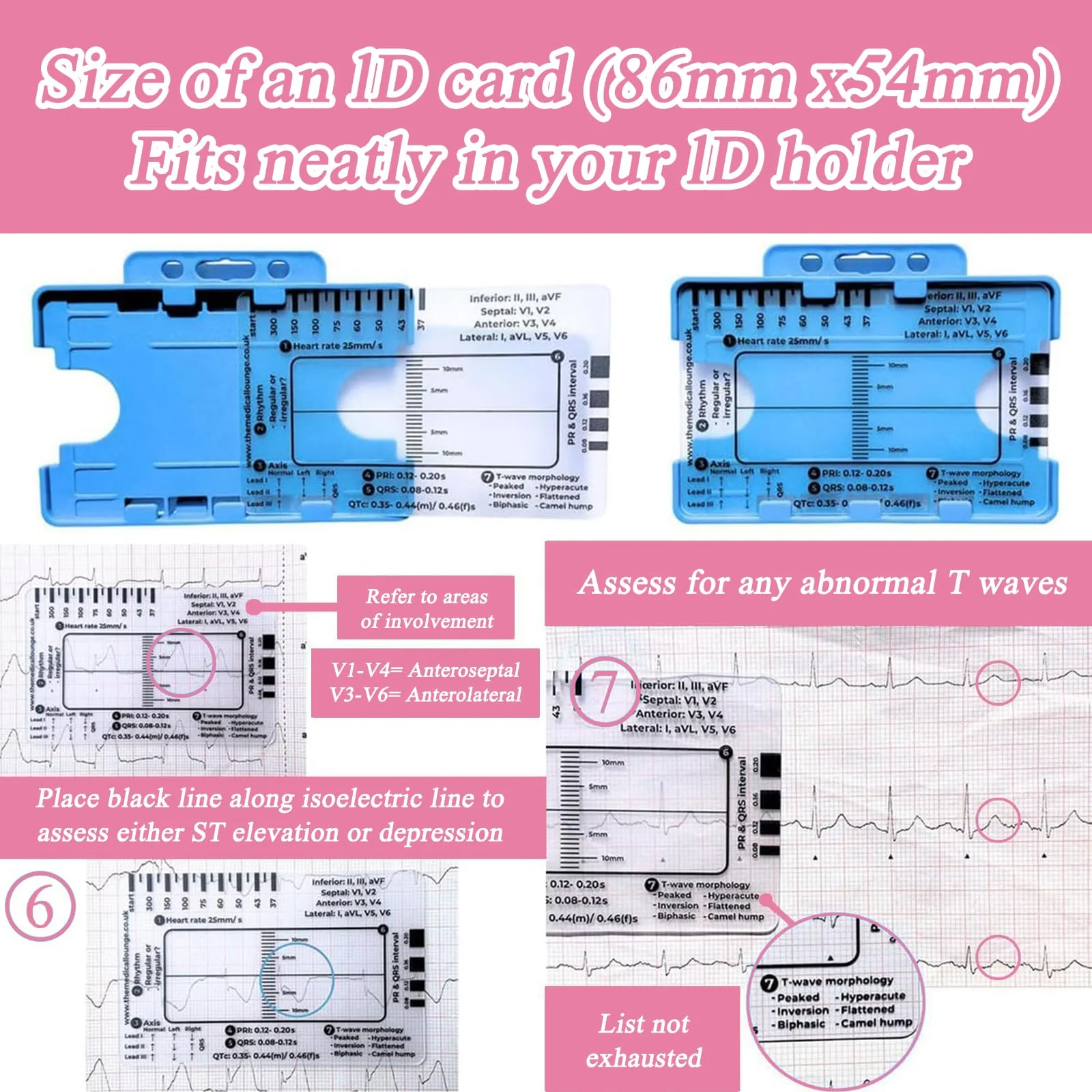 Ecg 7 Step Ruler, Ecg/Ekg 7 Step Ruler Card, Portable Ecg Ruler Plastic Ruler Measuring Tool, Provides Data Support, Wear-resistant and Durable, Suitable for Doctors, Medical Students, etc. - Image 7