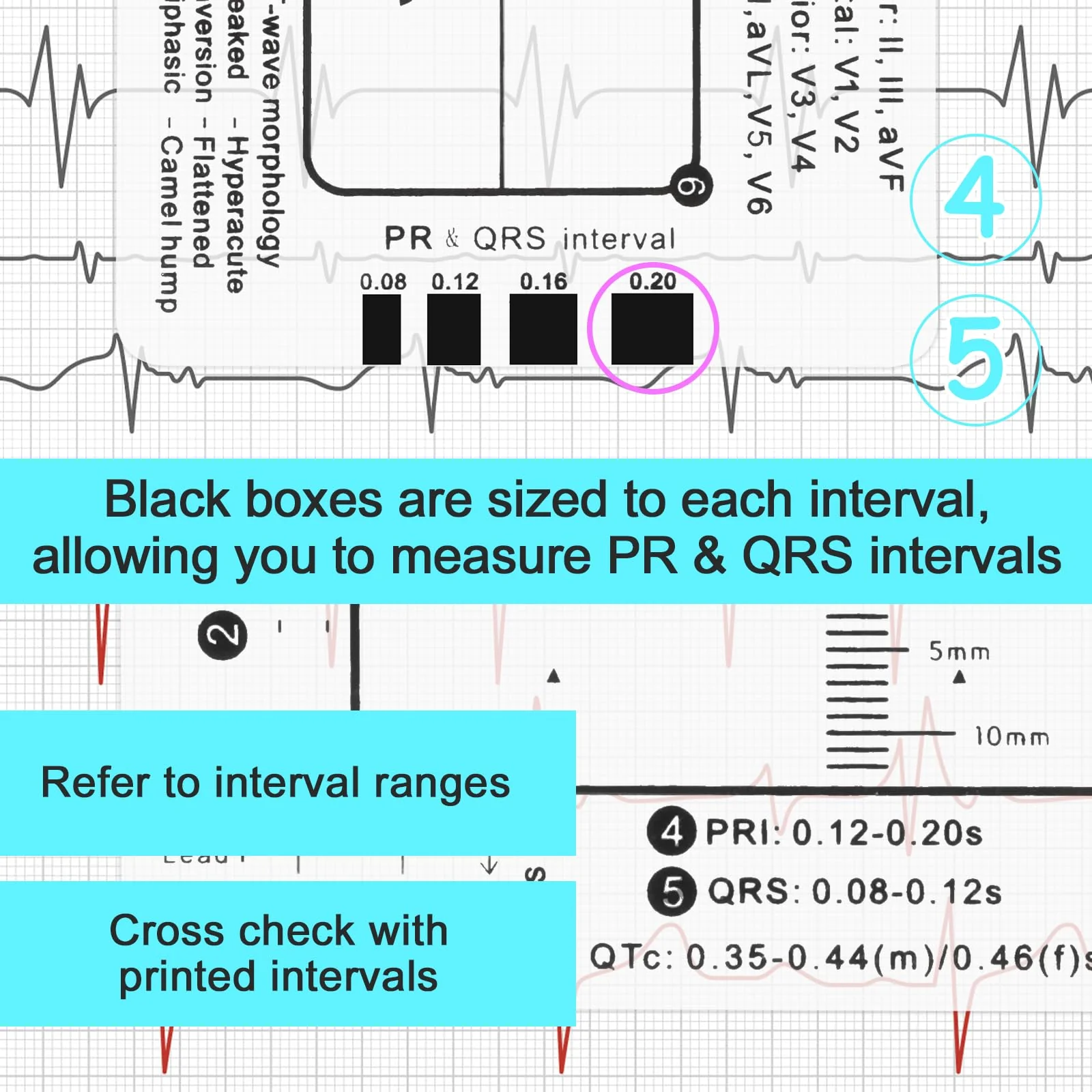 ECG 7 Step Ruler, Portable ECG Assessment Tool ECG/ECG 7 Step Ruler Card for ECG/ECG Interpretation ECG Ruler Plastic Ruler Measuring Tool ECG ECG Card Ruler ECG Reference Guide with Protect Sheath - Image 6