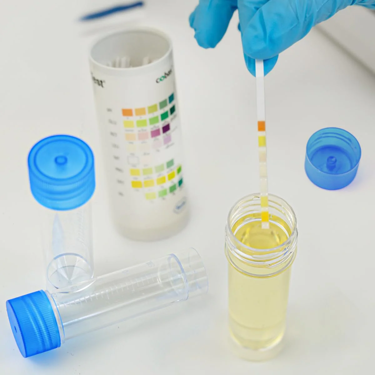 FERCAISH Pack of 10 Sample Tubes with Blue Screw Lid, 30 ml Sample Tube, Disposable Urine Tubes, Plastic Marker, Test Tubes, for Laboratory and Hospital - Image 5