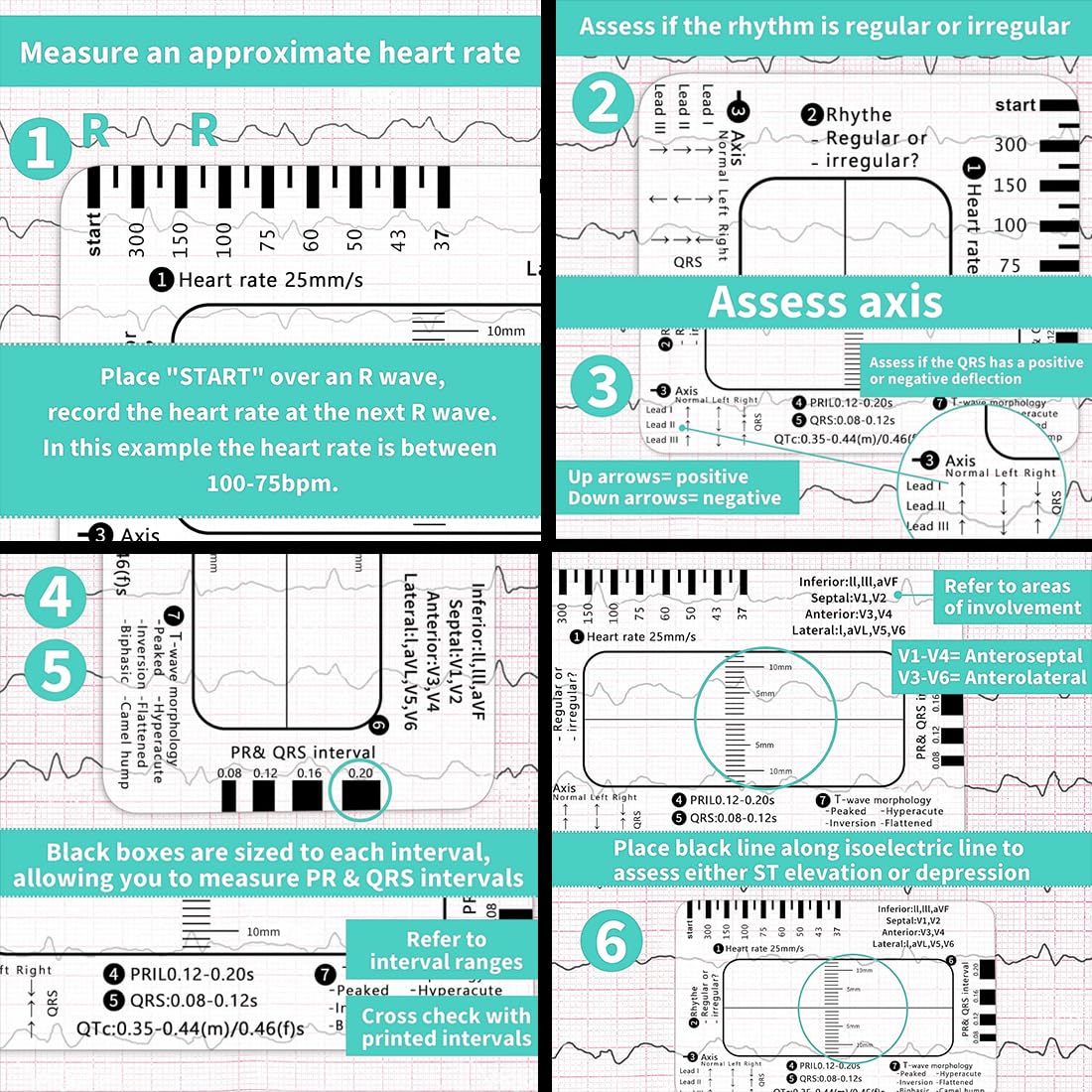 HQRKOTM ECG 7 Level Ruler Card for ECG/ECG Interpretation, Portable Bag, Plastic, 85.6 mm x 53.98 mm, Medical Instrument, Simple Plastic Construction, ECG 7 Step Ruler, Pack of 2, a - Image 4