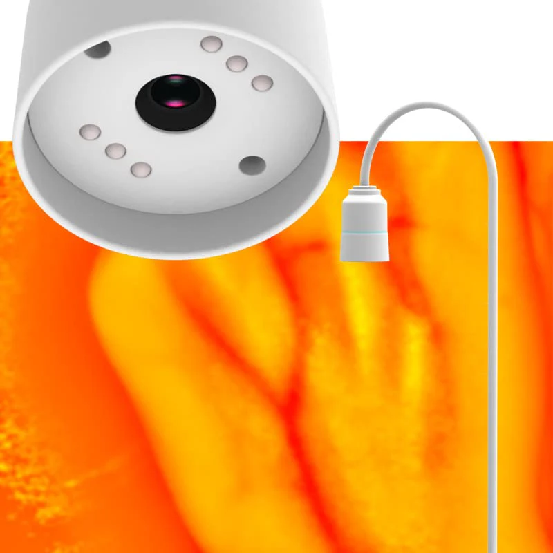HURRISE Vein Finder Illuminates Imaging Vein Finder Transilluminator Permanent Vein Finder Display Machine Transilluminator Vein Finder for Hospital - Image 6