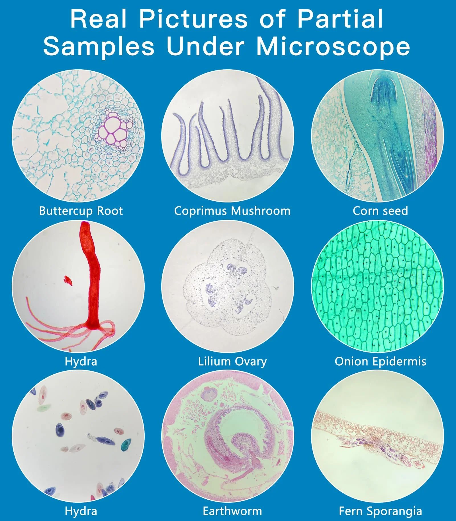 Microscope Slides with Specimens for Kids, 60 Lab-Grade Prepared Microscope Slides, Animal/Plant/Microbe/Tissue Samples, STEM Biology Kit for Homeschool, Classroom Labs & Science Education Ages 8+ - Image 8