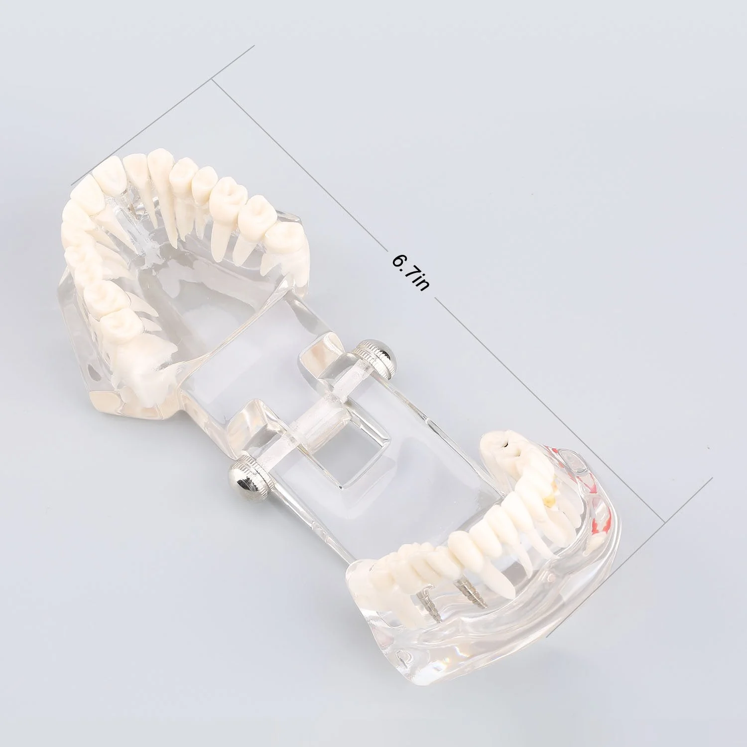 Model of Dentist Training, Dental Implant Disease Teaching Study Analysis Adult Typodont Demonstration Teeth Model New - Image 2