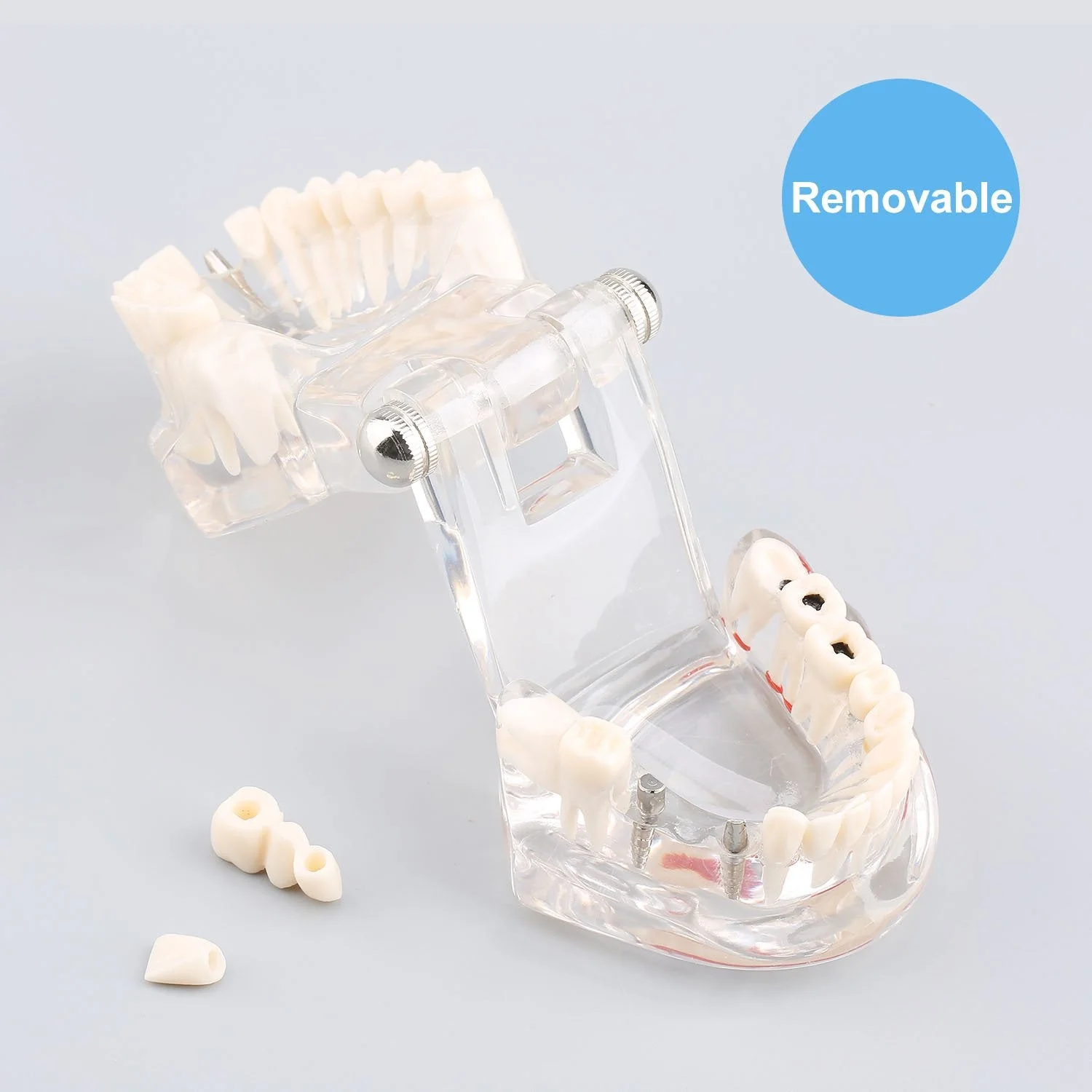 Model of Dentist Training, Dental Implant Disease Teaching Study Analysis Adult Typodont Demonstration Teeth Model New - Image 5