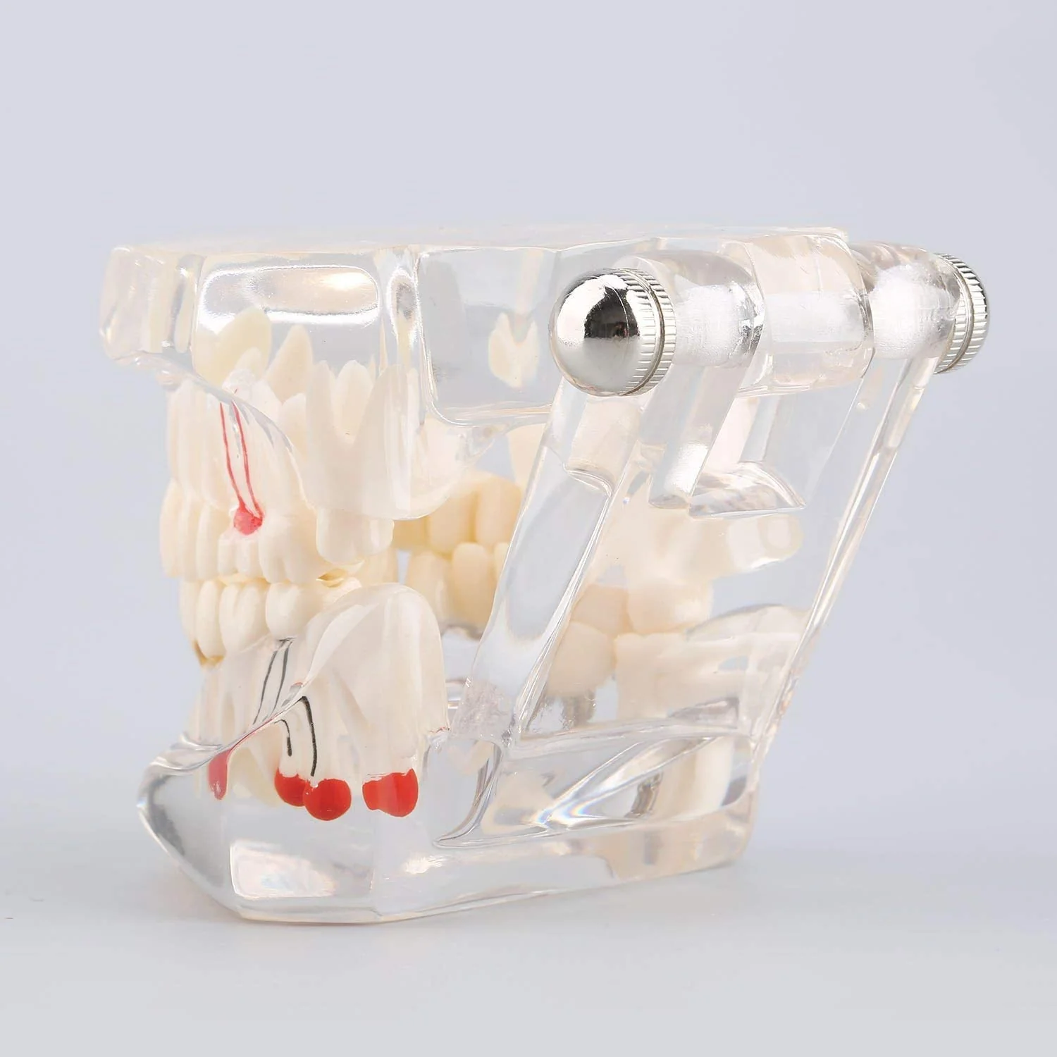 Model of Dentist Training, Dental Implant Disease Teaching Study Analysis Adult Typodont Demonstration Teeth Model New - Image 6