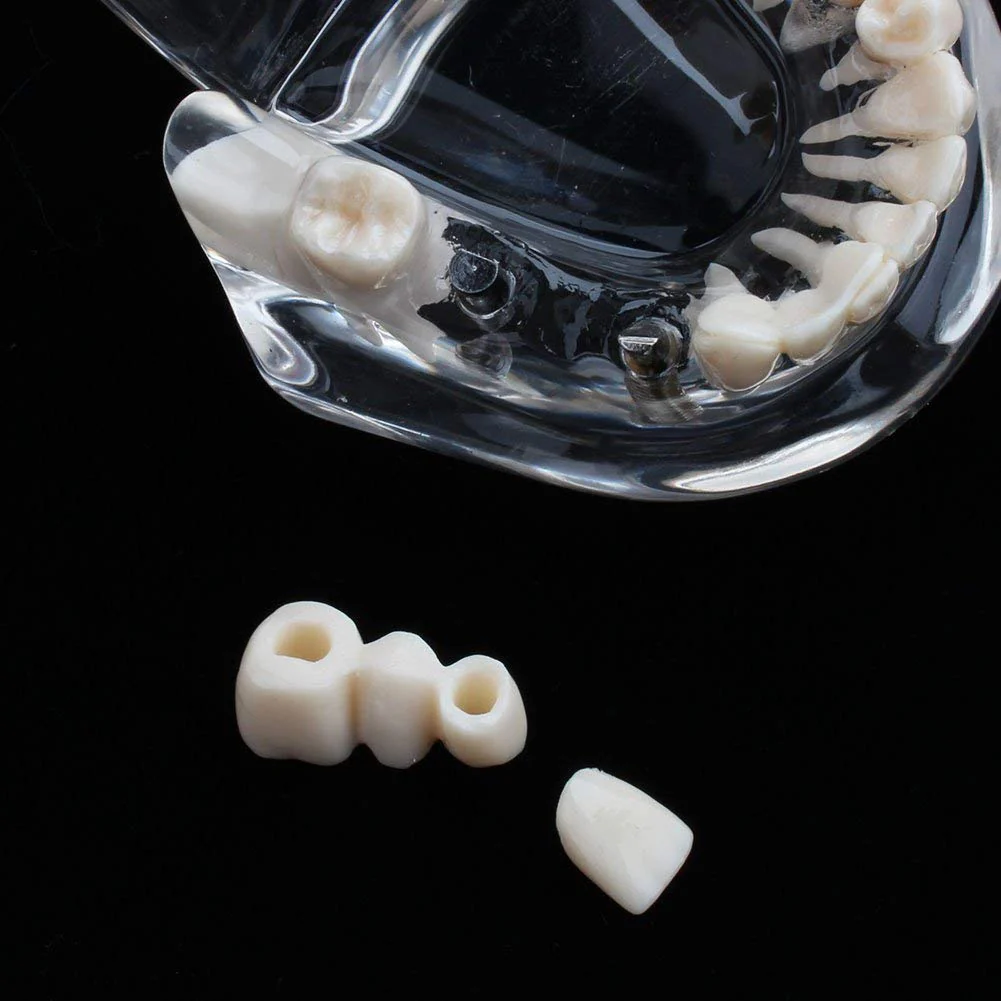 Model of Dentist Training, Dental Implant Disease Teaching Study Analysis Adult Typodont Demonstration Teeth Model New - Image 7