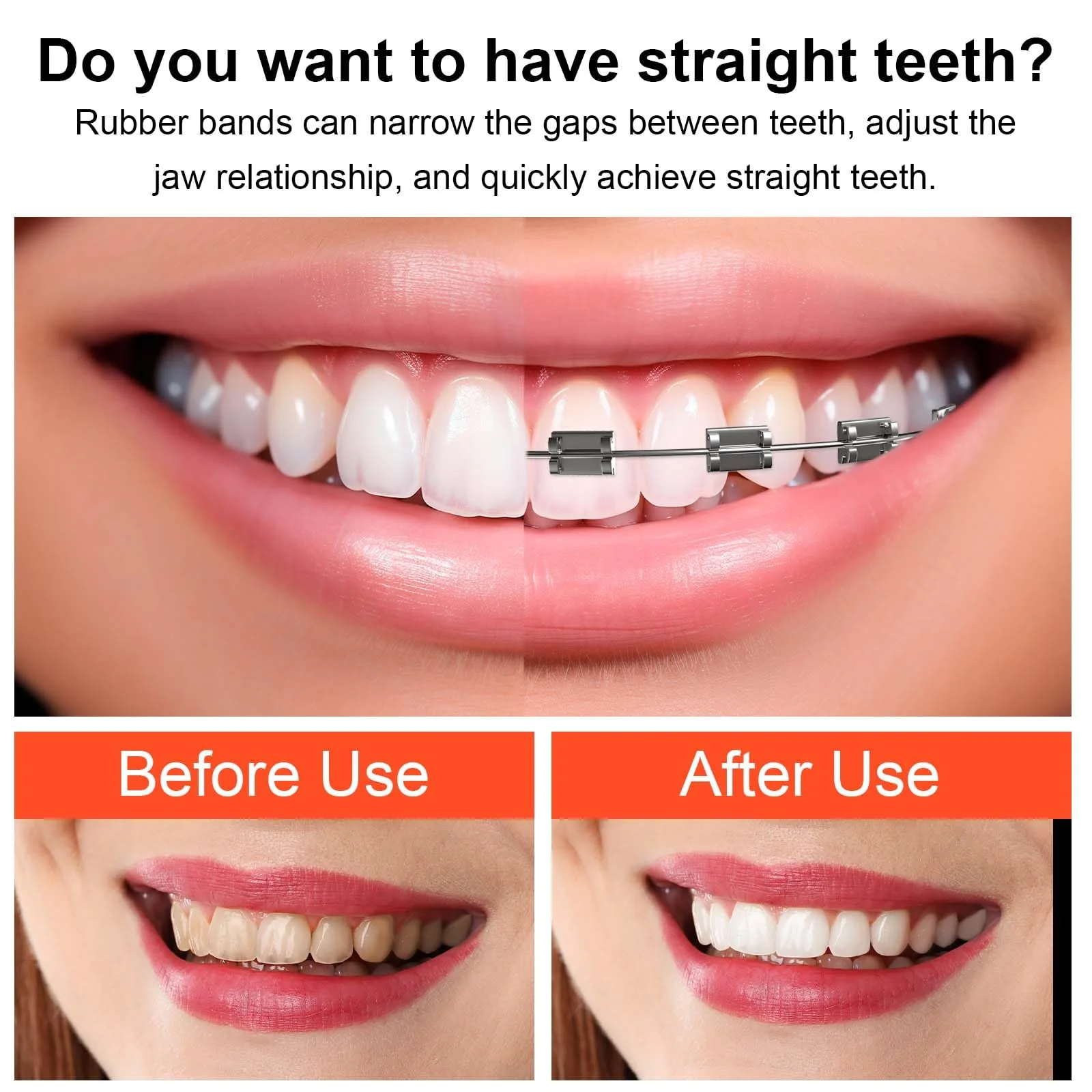 Orthodontic Rubber Bands 3/16 - Image 4