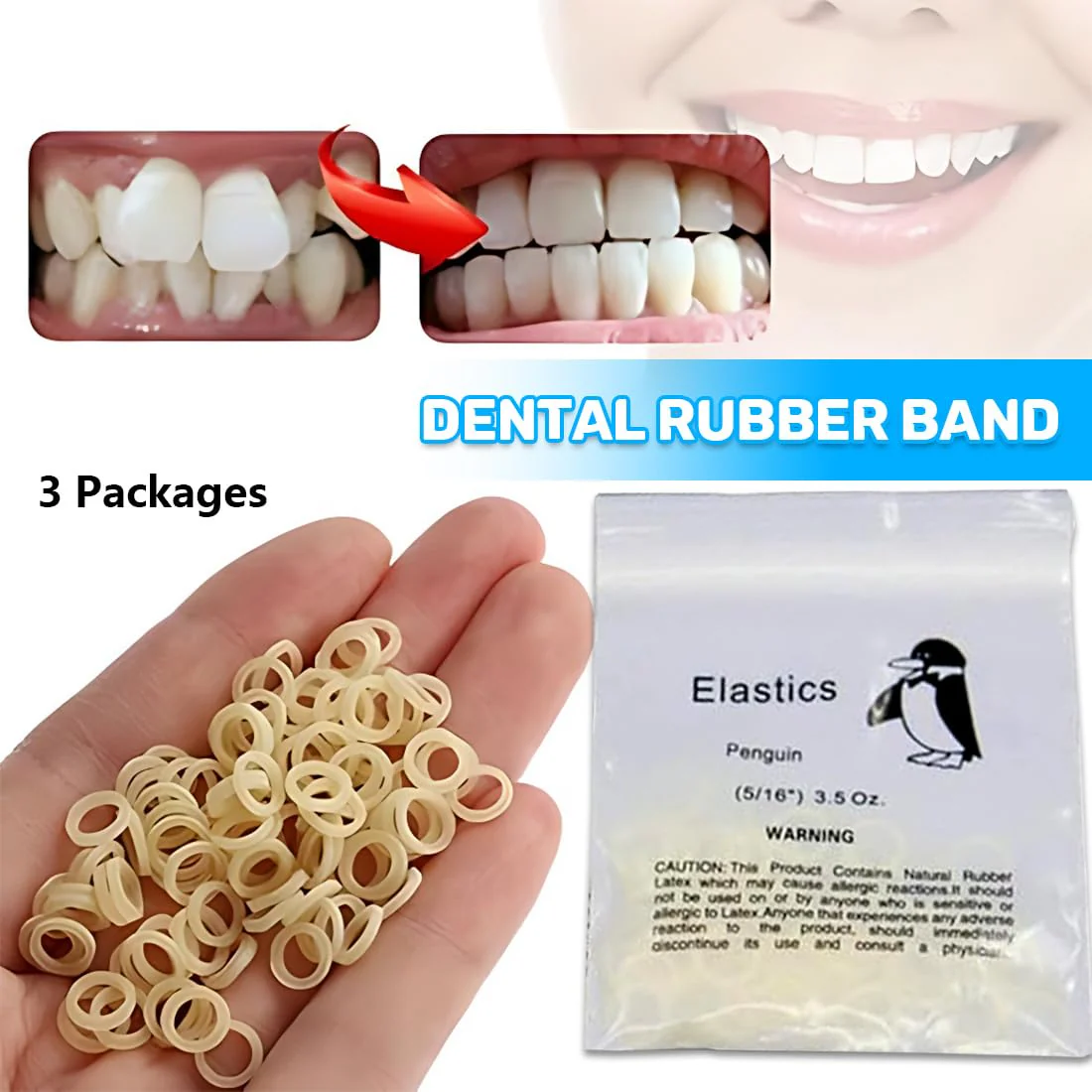 Orthodontic Rubber Bands, Pack of 300 Elastic Teeth Elastic Bands with 5 Placers for Braces, 5/16 Inch Orthodontic Elastics for Braces Dreadlocks Tooth Gap Braces - Image 3