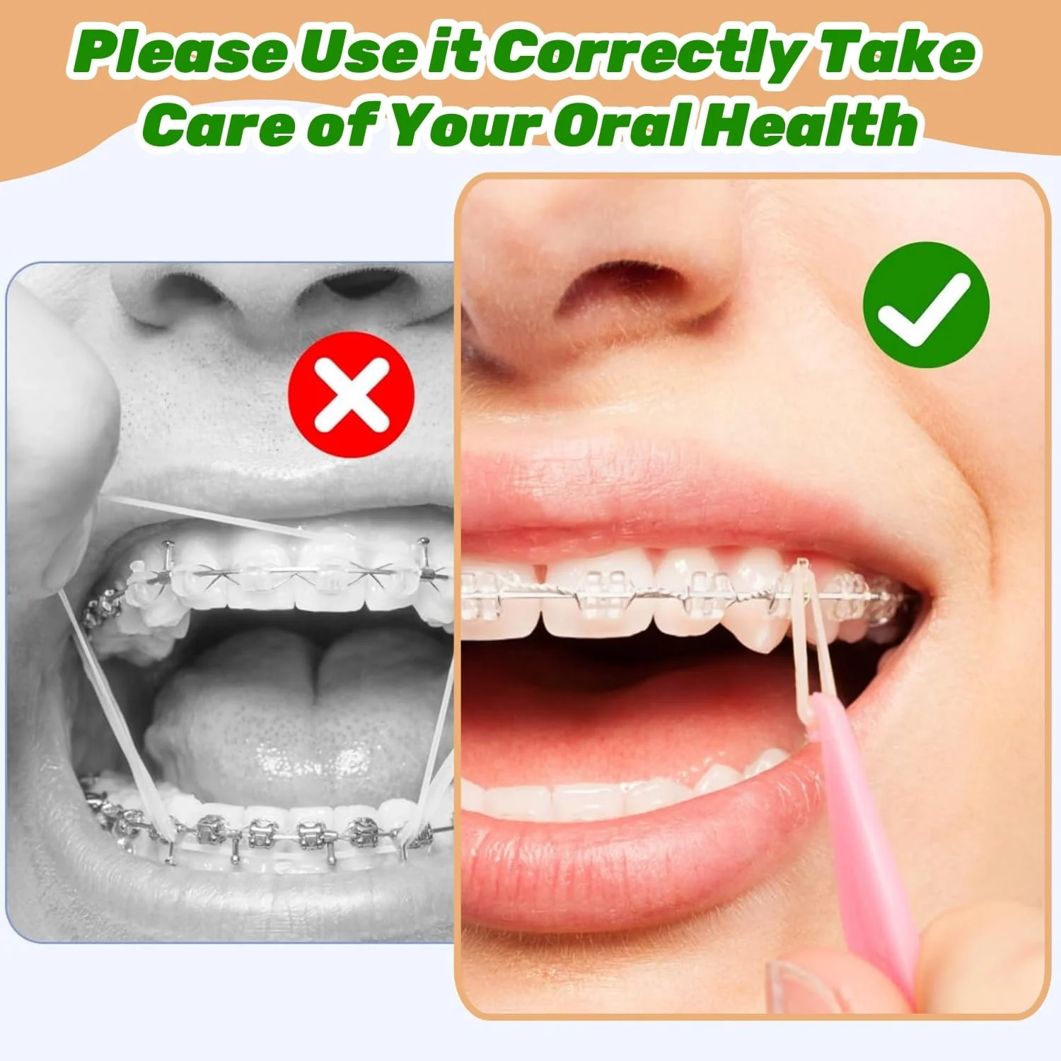 Pack of 500 Braces Rubber, Orthodontic Rubber Bands, Orthodontic Elastic with 10 Pieces Placer Braces Can Be Used for Orthodontics - Image 6