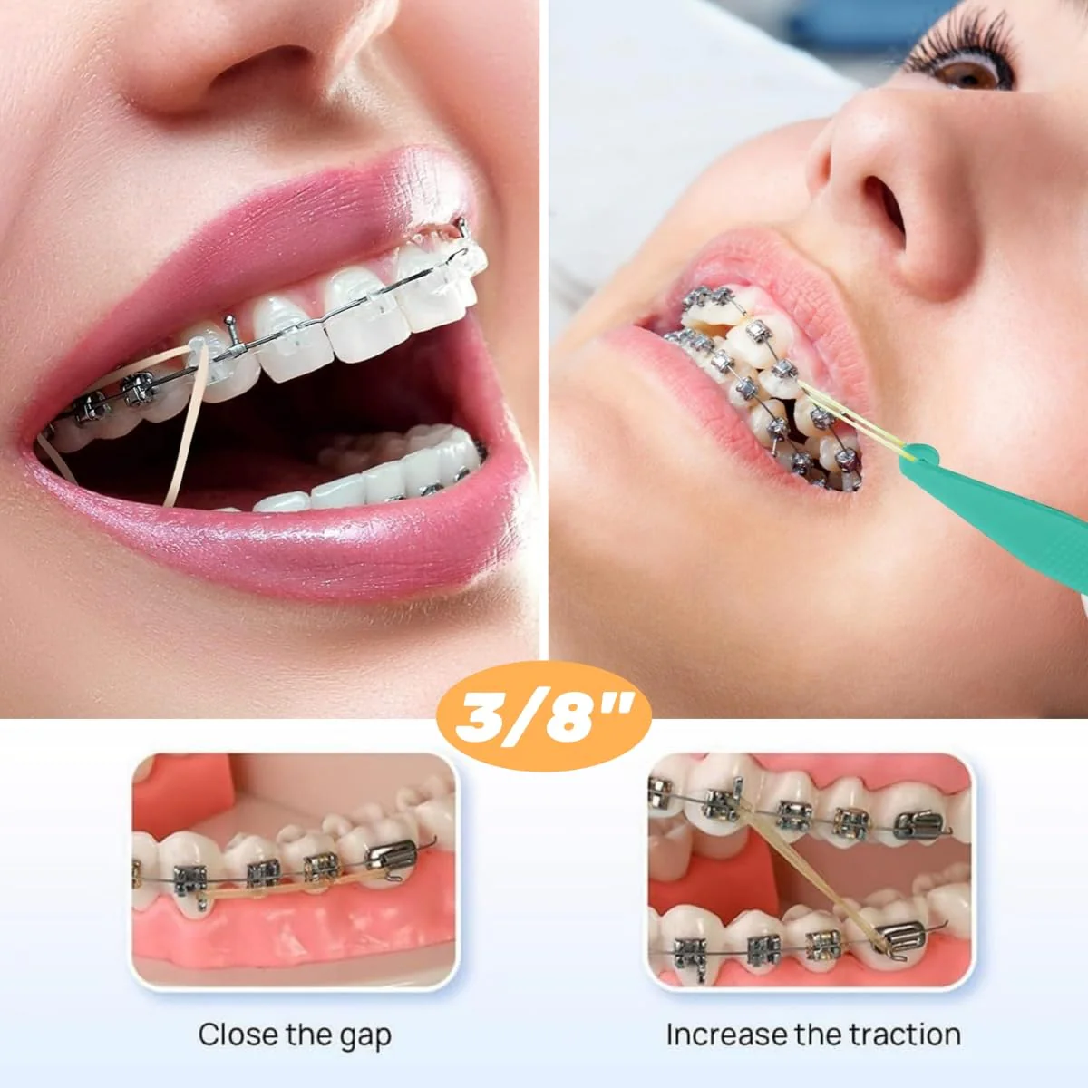 Pack of 500 Braces Rubber, Orthodontic Rubber Bands, Orthodontic Elastic with 10 Pieces Placer Braces Can Be Used for Orthodontics - Image 7