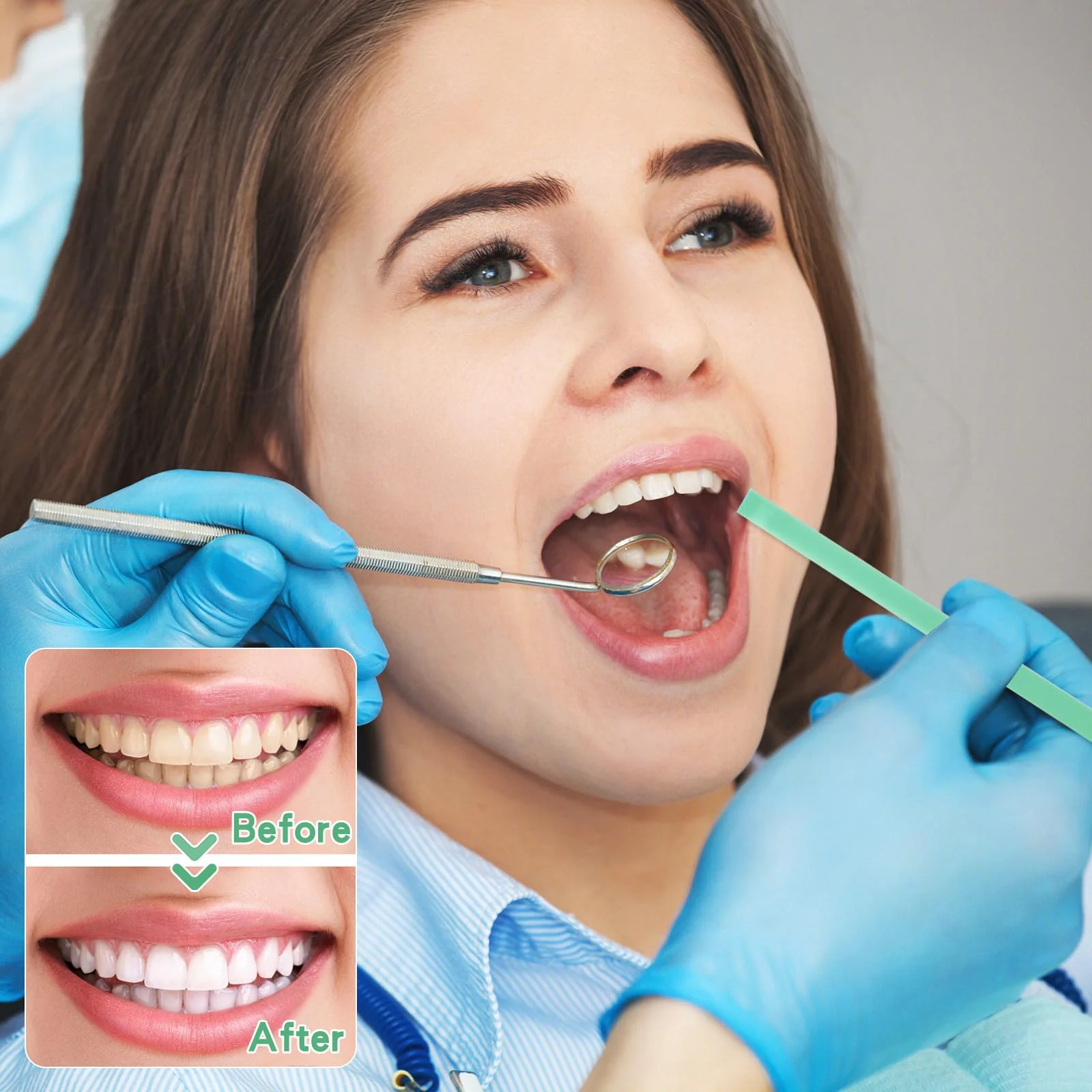 Pack of 75 Tooth Sandpaper, 4 mm x 145 mm Wide Dental Polishing Strips, Sanding Finish Polishing Strips, Tooth File, 3 Colours, Wear-Resistant Plastic Sandpaper, NatureAqua Resin Tooth Polishing - Image 4
