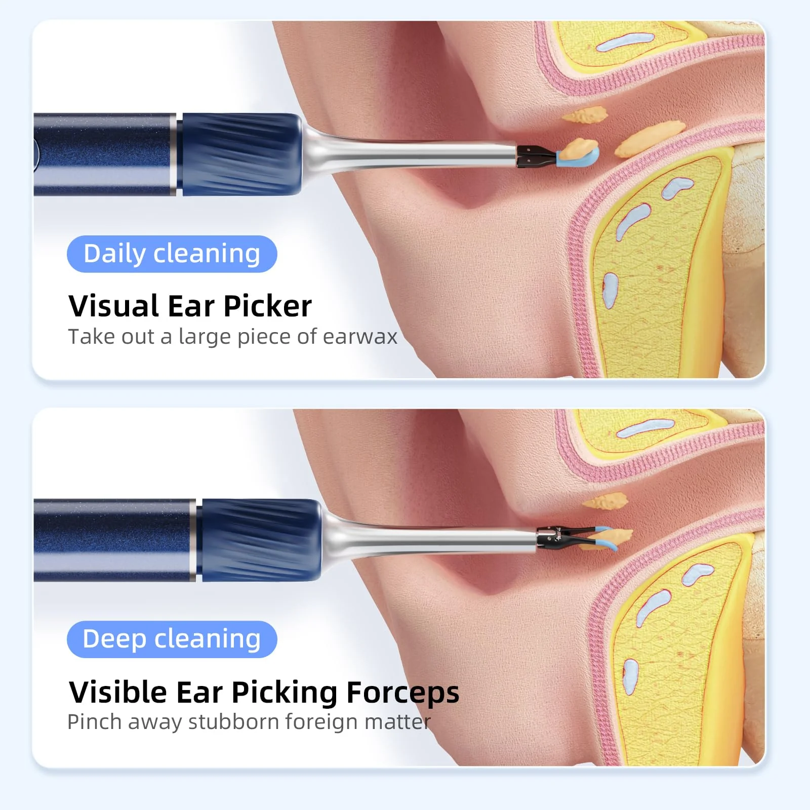 Qimic Ear Wax Remover Otoscope, 1080P HD WiFi Ear Cleaner, Ear Camera with Tweezers & 4 LEDs, Otoscope for iOS & Android, IP67 Waterproof Ear Cleaner for Adults, Children and Pets S8 blue - Image 5