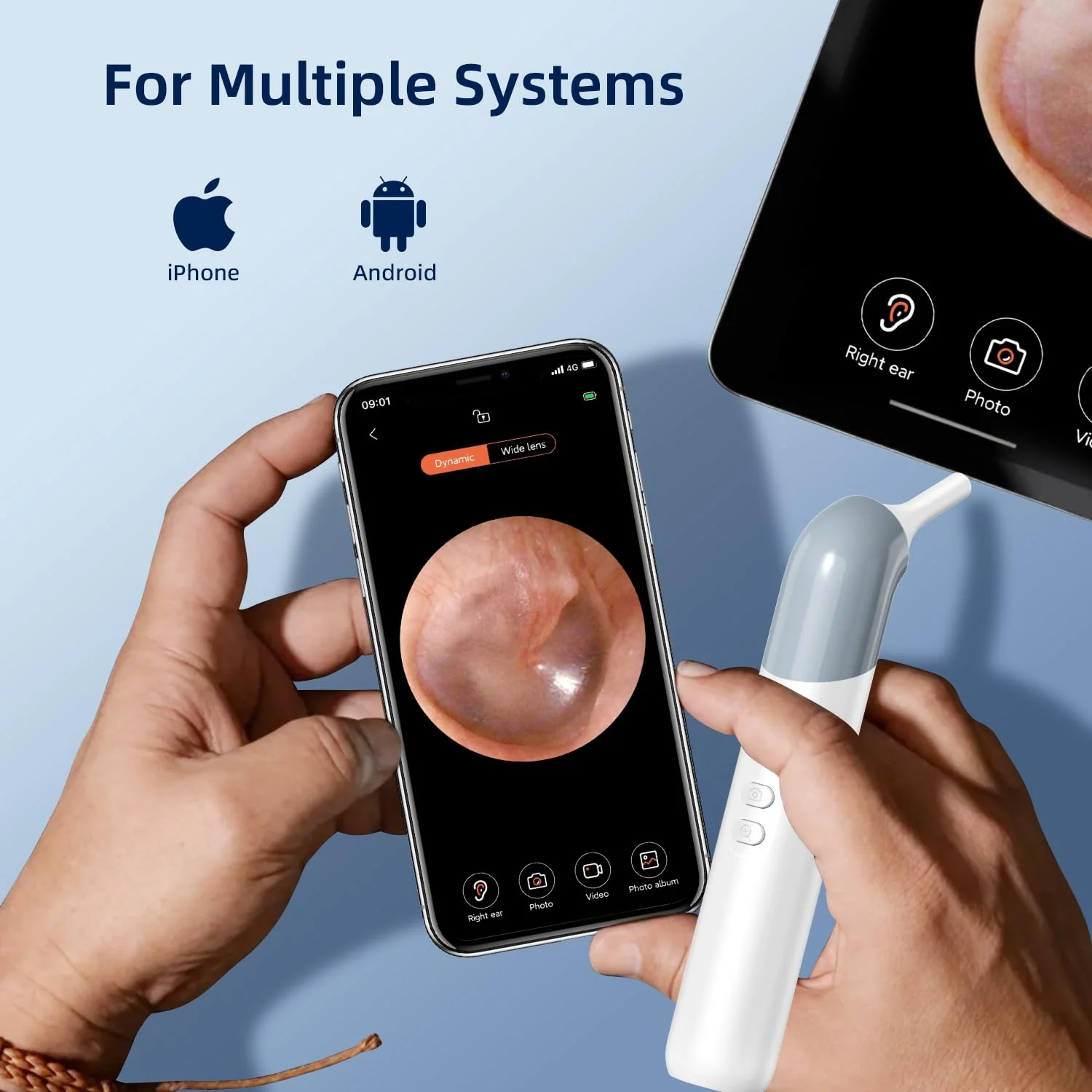 Qimic Wireless Otoscope Ear Camera - 1080P WiFi Otoscope with 6 LED Lights, Ear Scope Camera with 10 Colorful Accessories for Kids,Pets &Adults,Support Photo and Video, Compatible with Android Q09 - Image 8