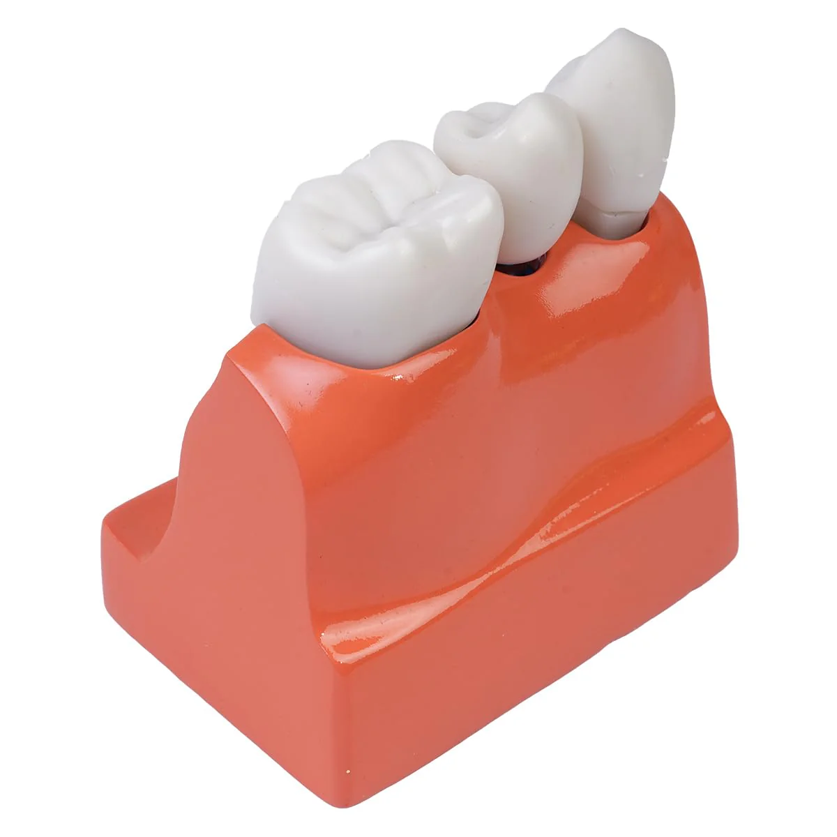 Sarini Oral Dental Model, Dental Implant Model with Removable Crown and Bridge, Suitable for Classroom Demonstrations and Dental Student Training - Image 2