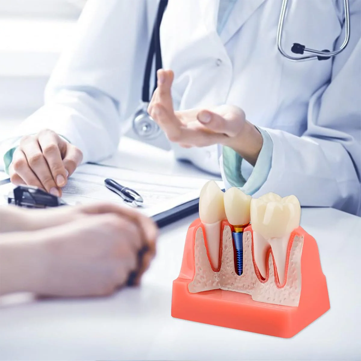 Sarini Oral Dental Model, Dental Implant Model with Removable Crown and Bridge, Suitable for Classroom Demonstrations and Dental Student Training - Image 5
