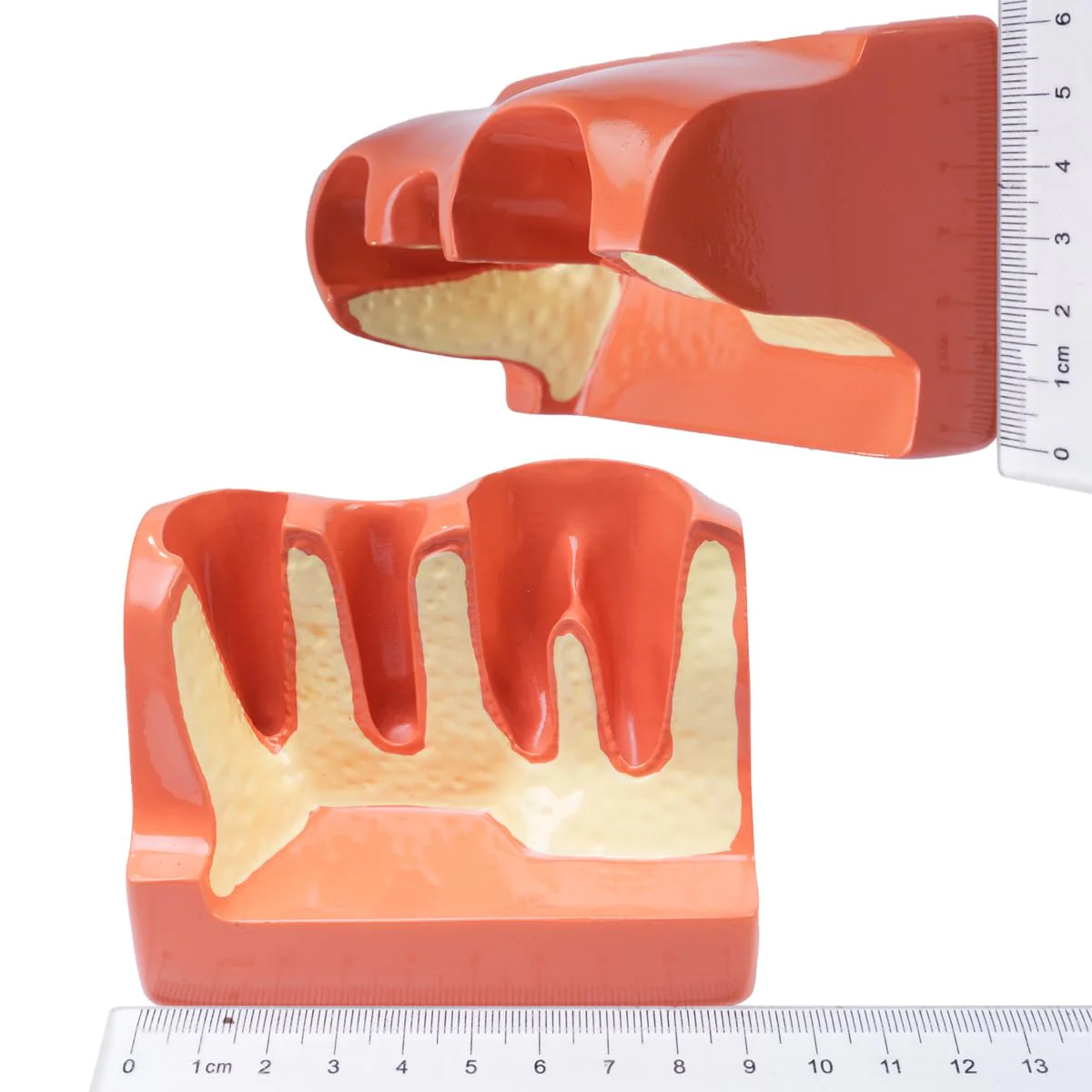 Sarini Oral Dental Model, Dental Implant Model with Removable Crown and Bridge, Suitable for Classroom Demonstrations and Dental Student Training - Image 6