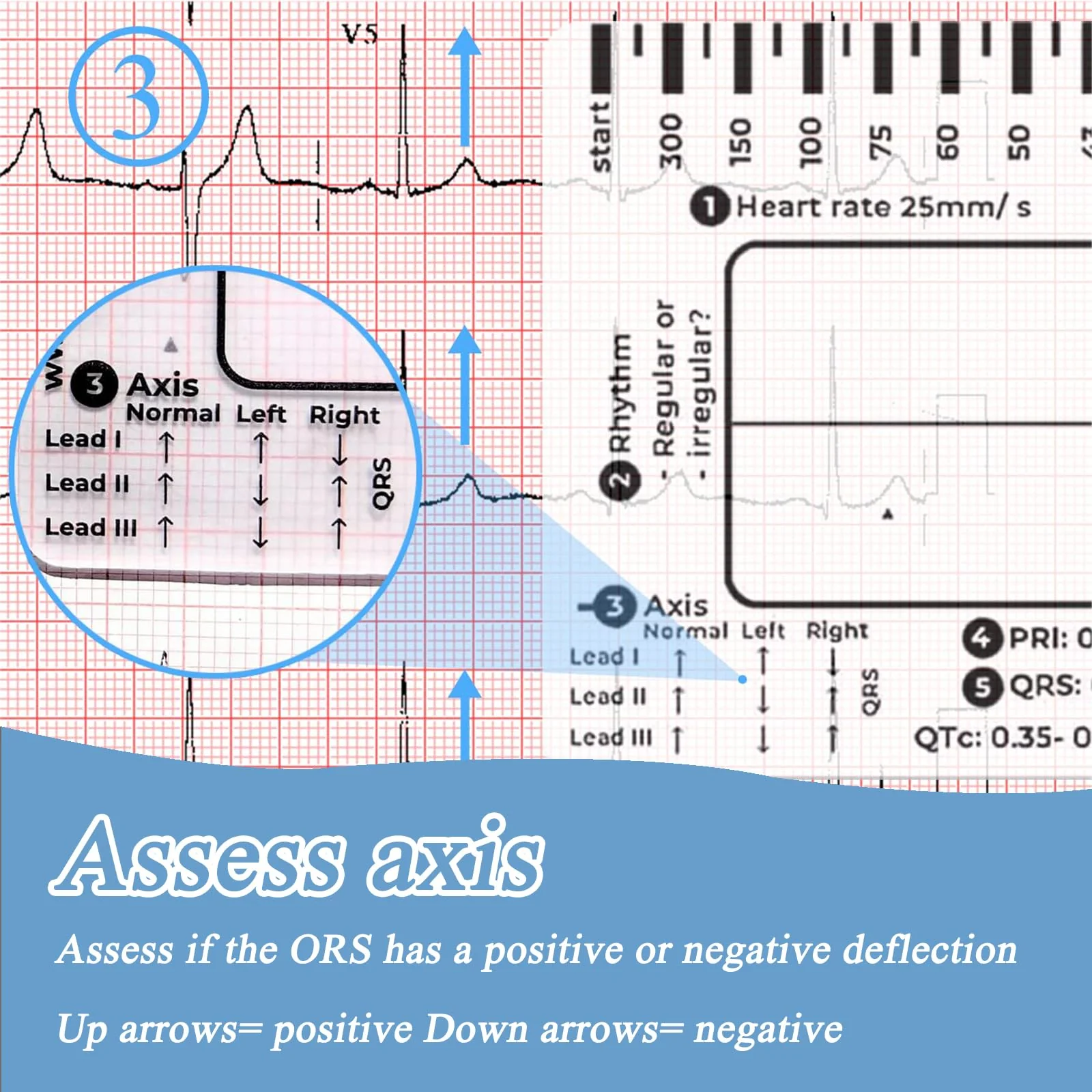 SNONESIY ECG 7 Step Ruler, Transparent ECG Calipers Meter, Plastic, 9 x 6.5 cm - Image 4