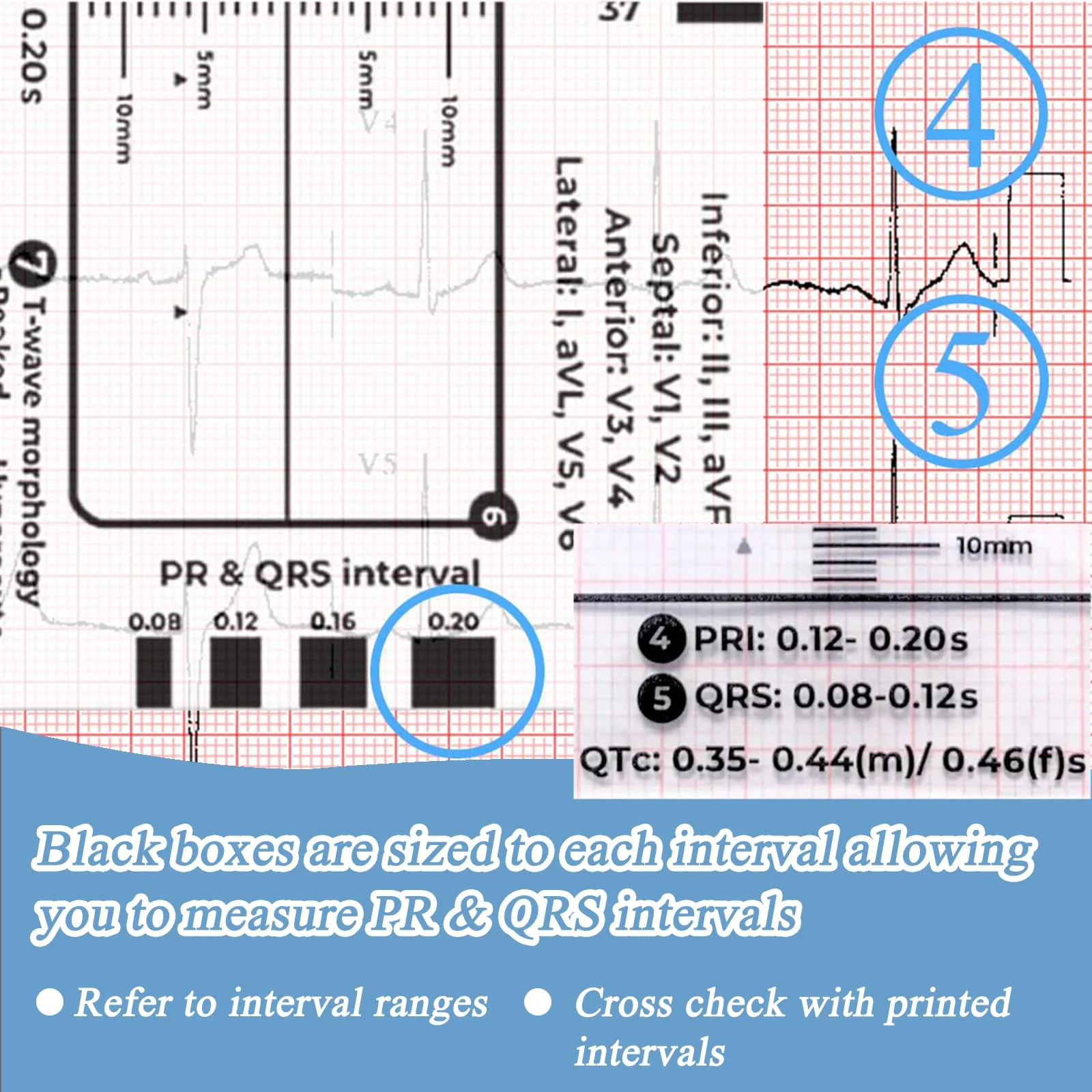 SNONESIY ECG 7 Step Ruler, Transparent ECG Calipers Meter, Plastic, 9 x 6.5 cm - Image 5