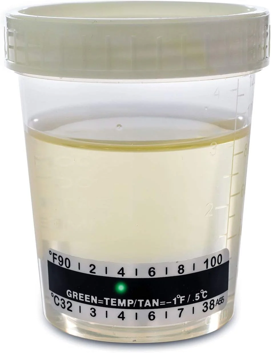 Sterile Urine Cup / Sample Cup Screw Top 120ml with Temperature Indicator Pack of 5 - Image 5