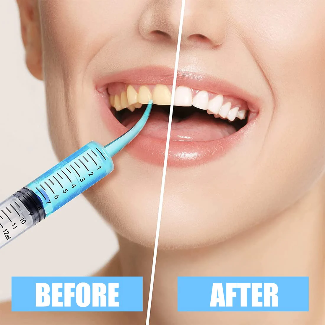 Syringe 12 ml Plastic Curved Syringe Mouth Syringe Dental Irrigation Syringe Wisdom Teeth Syringe for Oral Dental Care Cleaning - Image 6