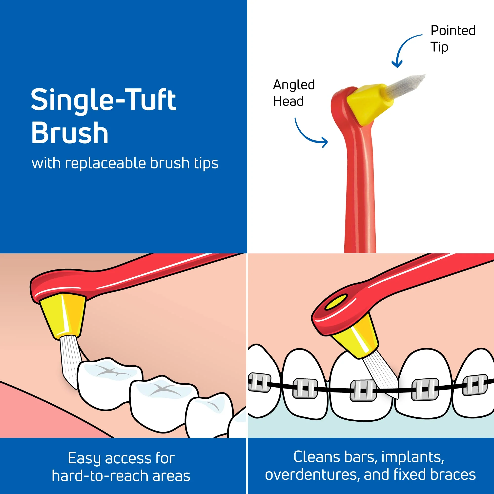 TePe Interspace Angled Soft Toothbrush for Braces with Single-End Tuft and Removable Head, 12 Pack - Image 3