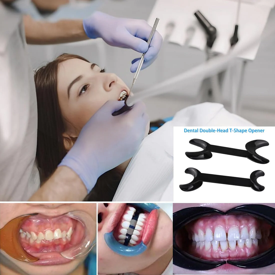 TISCH 4 Pieces Autoclavable Double Head Mouth Opener, Dental T Shape Lip Cheek Holder for Teeth Whitening for Dentist, Oral Care, Party, Mouth Guard, Pronouncing (Black/Two Sizes) - Image 6