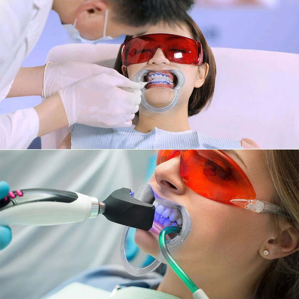 Vicloon Cheek Holder Mouth Angle Holder for Mouth Opener Challenge, 10 Pieces Dental C-Shape Mouth Opener for Teeth Whitening (Transparent) Transparent - Image 6