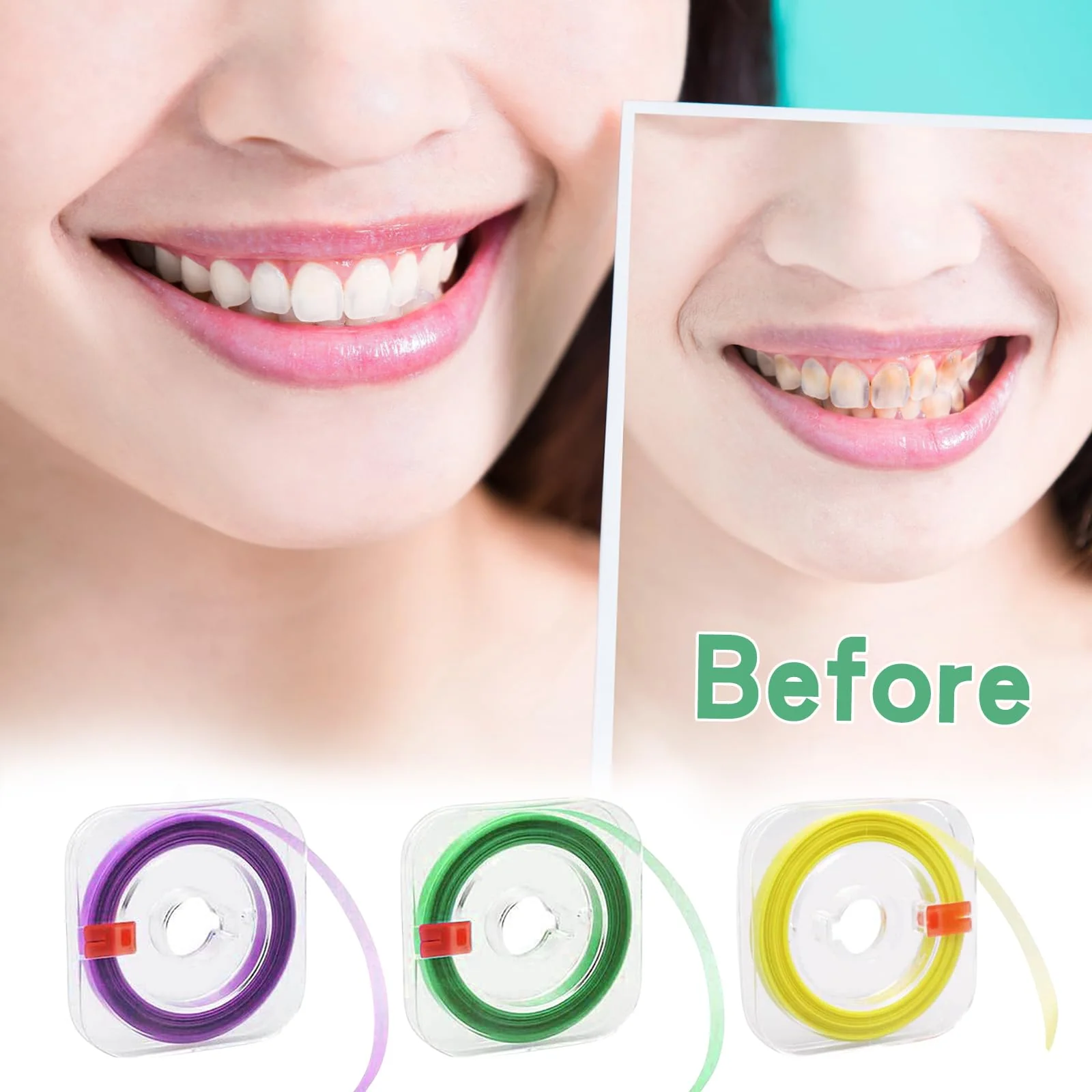 Zimoer Tooth Sandpaper, 3 Volumes Dental Polishing Strips, 20/30/50μm Size of Grains, Teeth Sandpaper for Spaces, Interdental Sanding Tools for Polishing Teeth, 4 mm x 6 m / Rolls - Image 5