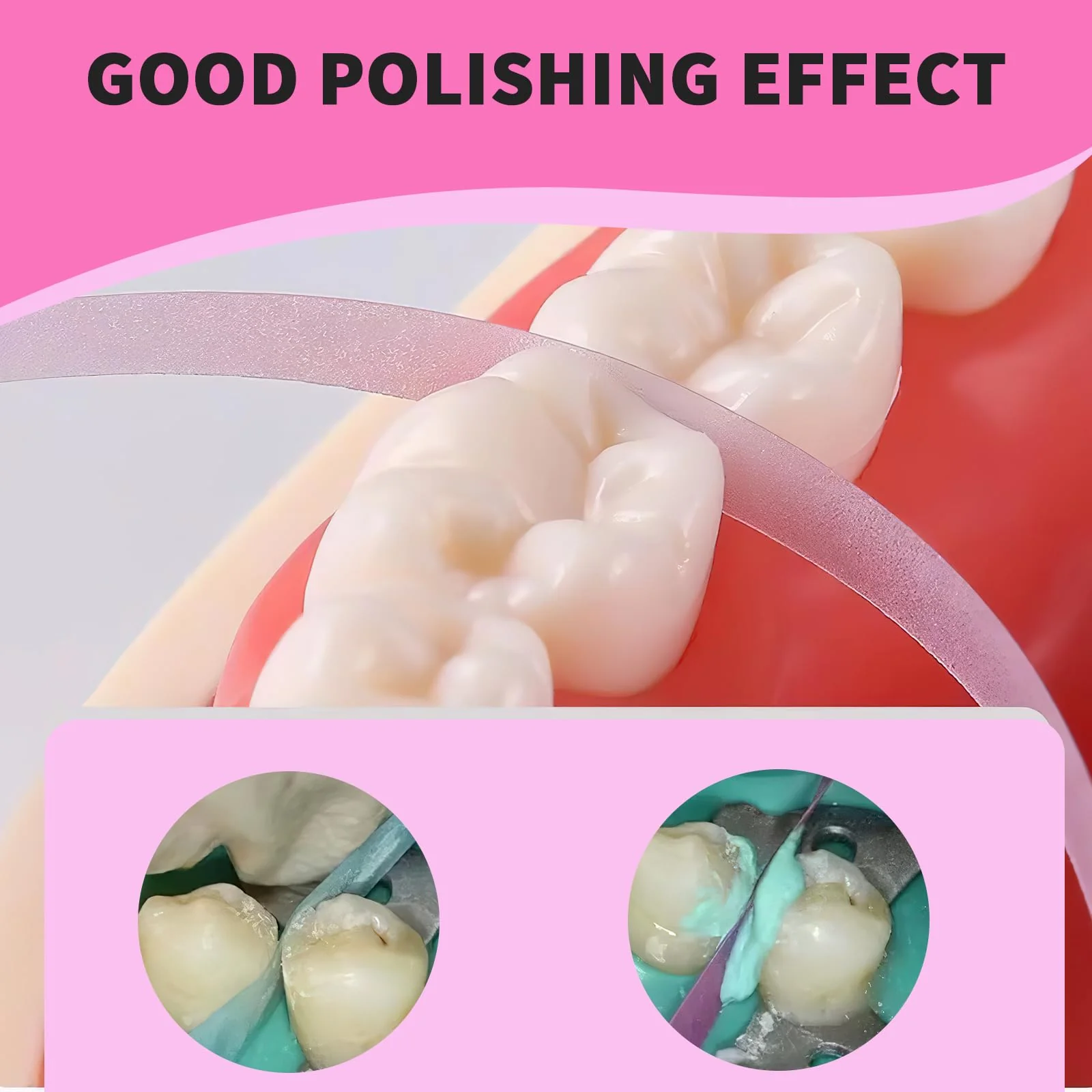 Zonoori 3 Volumes Tooth Sandpaper Polishing Strips, Teeth Sandpaper Tooth Belt for Polishing Teeth (4 mm x 6 m) - Image 4
